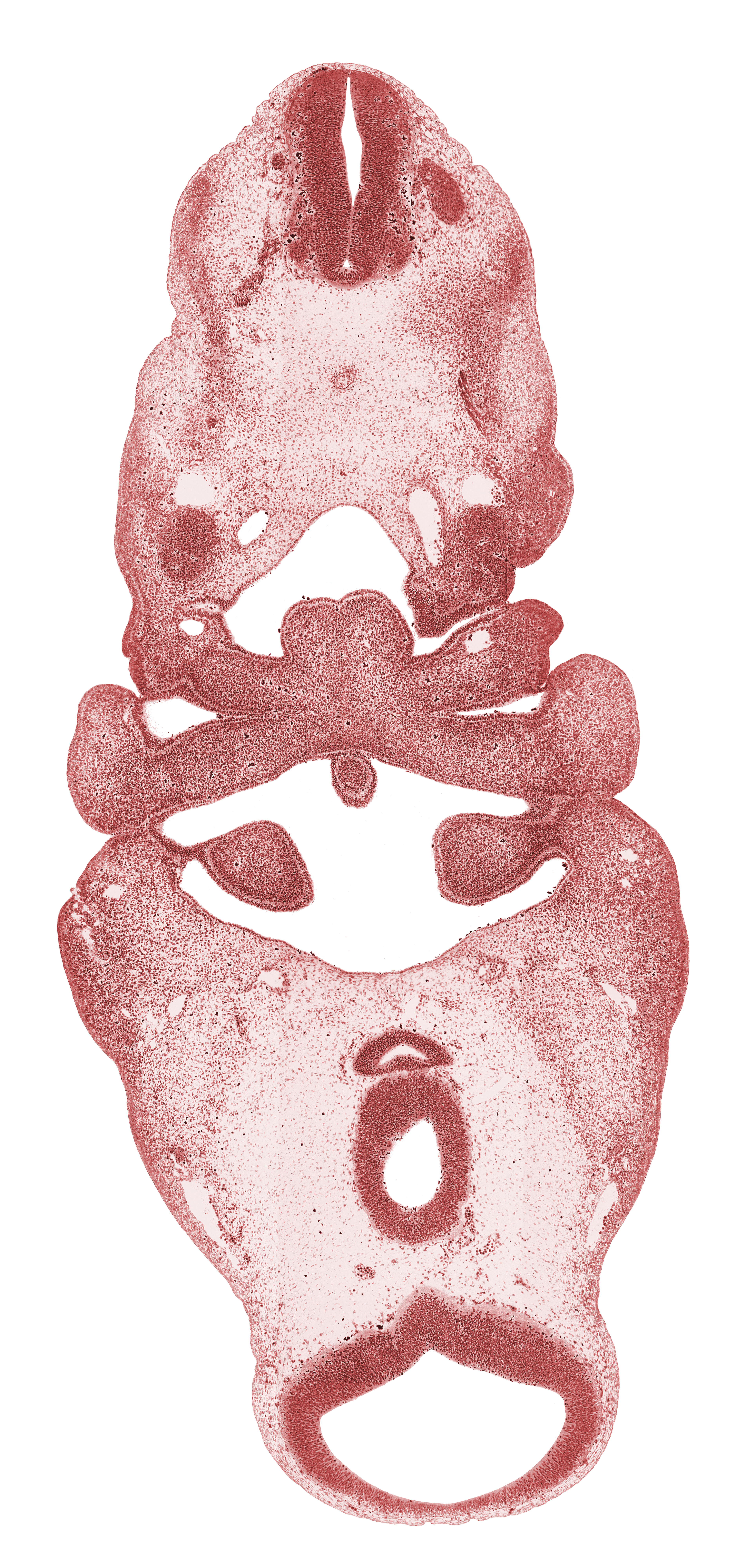 C-1 spinal nerve, aortic arch 3, aortic arch 4, cephalic edge of C-2 spinal ganglion, diencephalon, diencoel (third ventricle), dorsal aorta, edge of adenohypophysial pouch, hypopharyngeal eminence of tongue, inferior ganglion of vagus nerve (CN X), lateral lingual swelling of tongue, mesencephalon (M1), mesencoel (cerebral aqueduct), notochord, pharyngeal arch 3, pharyngeal arch 4, pharyngeal groove 1, pharyngeal pouch 2, posterior communicating artery, precardinal vein, spinal accessory nerve (CN XI), spinal cord, thyroglossal duct, tuberculum impar of tongue