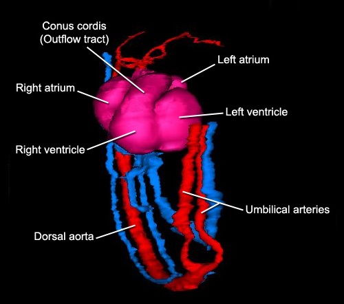 Circulation - Anterior Circulation