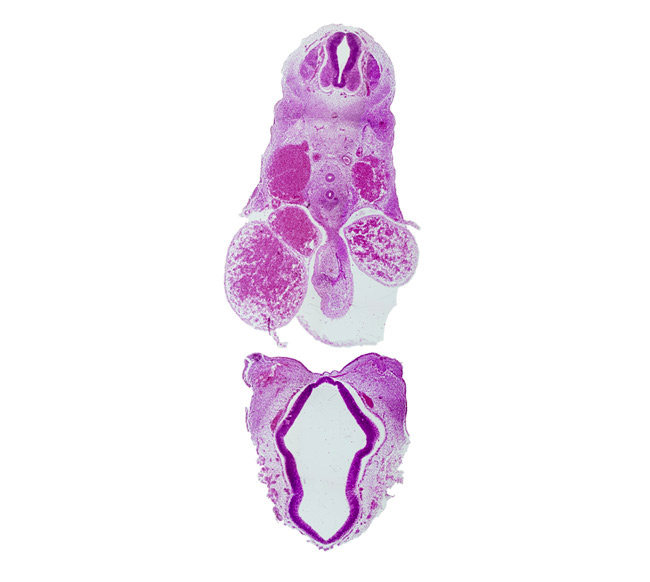 C-5 spinal ganglion, caudal edge of lateral ventricle, disrupted pericardial sac, dorsal aorta, dorsal thalamus, esophagus, junction of maxillary and medial nasal prominences, left atrium, notochord, primordial olfactory artery, right atrium, third ventricle, trachea, ventral thalamus