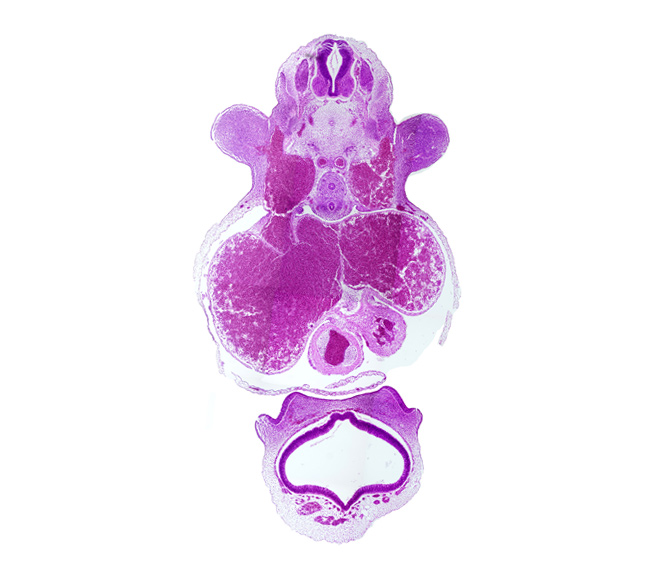 C-6 spinal ganglion, cerebral vesicle (telencephalon), dorsal aorta, esophagus, lateral ventricle, left atrium, left ventricle, nasal disc (olfactory placode), primary interatrial septum (septum primum), right atrium, sinus venosus, subclavian vein, third ventricle, trachea, truncus arteriosus (outflow tract), vascular plexus