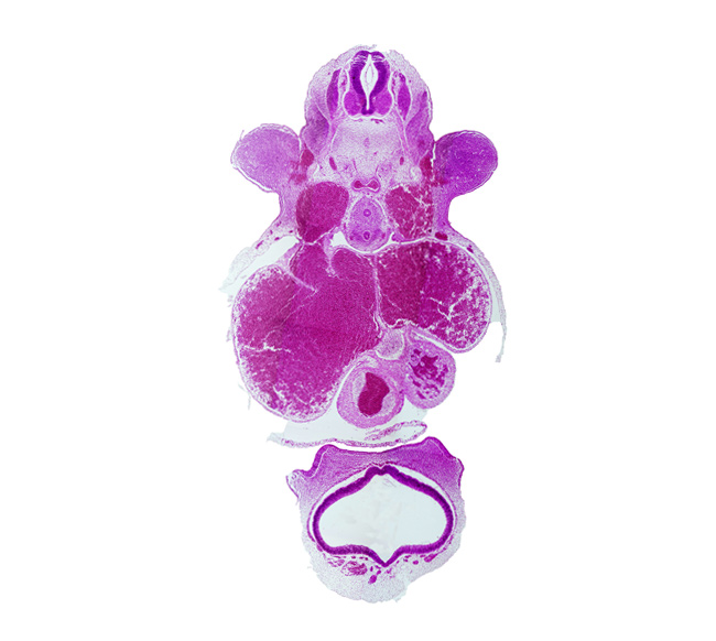 C-6 spinal ganglion, C-6 spinal nerve, central canal, cerebral vesicle (primordial cerebral hemisphere), dorsal aorta, esophagus, left atrium, left truncus ridge, left venous valve, left ventricle, marginal sinus, nasal disc (olfactory placode), neural arch blastema, notochord, pericardial cavity, primary interatrial septum (septum primum), right atrium, right common cardinal vein, right truncus ridge, right venous valve, sinus venosus, telencephalon medium, trachea, truncus arteriosus (outflow tract), upper limb