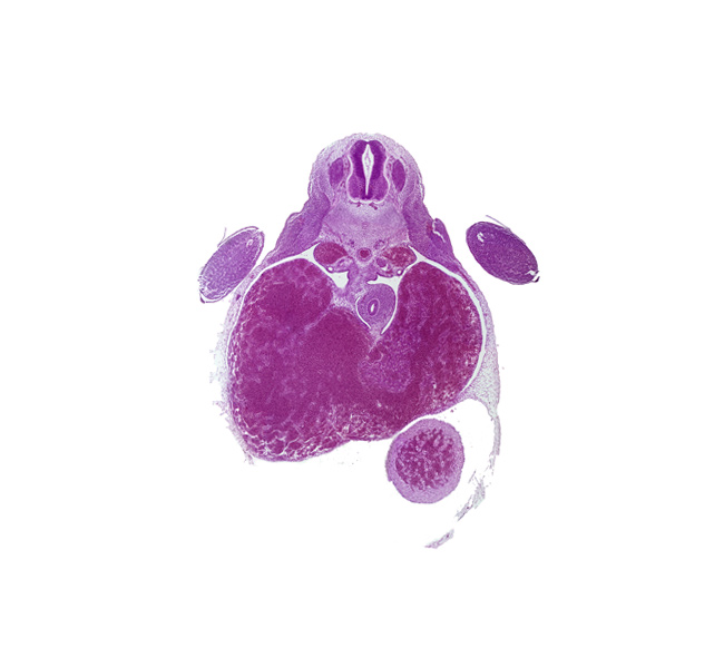 T-1 spinal ganglion, apical epidermal ridge, ductus venosus, left ventricle, liver, marginal vein, pericardial cavity, postcardinal vein