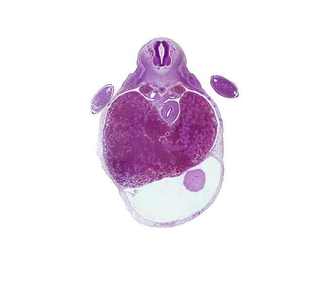 T-1 / T-2 interganglion region, aorta, caudal edge of left ventricle, ductus venosus, liver, mesonephric duct, myotome, neural arch blastema, pericardial cavity, peritoneal cavity, rib blastema, stomach endoderm, upper limb