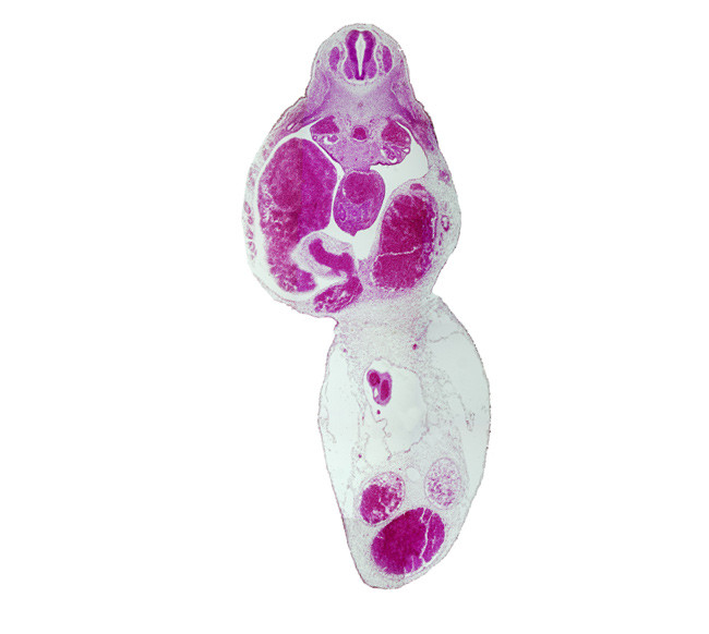 T-5 spinal ganglion, aorta, left umbilical artery, left umbilical vein (congested), liver, mesonephric duct, postcardinal vein, right umbilical artery, right umbilical vein, umbilical coelom, umbilical cord, umbilical vein, vitelline (omphalomesenteric) vein