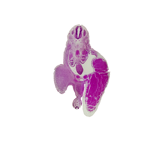 T-10 spinal ganglion, aorta, caudal eminence, gonadal ridge, hindgut, junction of allantois and primordial urogenital sinus, left umbilical artery, left umbilical vein (congested), lower limb (proximal part), mesonephric duct, peritoneal cavity