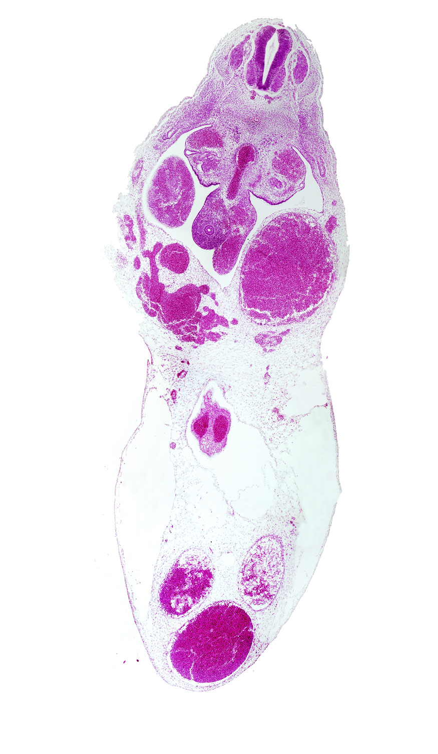 T-6 spinal ganglion, gonadal ridge, left umbilical artery, left umbilical vein (congested), liver, midgut, origin of superior mesenteric artery from aorta, right umbilical artery, right umbilical vein, umbilical cord, umbilical vein, vitelline (omphalomesenteric) artery, vitelline (omphalomesenteric) vein
