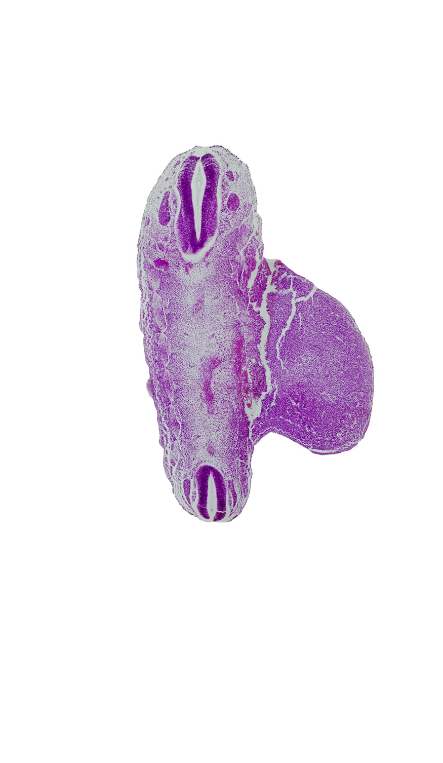 L-1 spinal ganglion, S-3 spinal ganglion, artifact fracture(s), caudal edge of aorta, lower limb, notochord