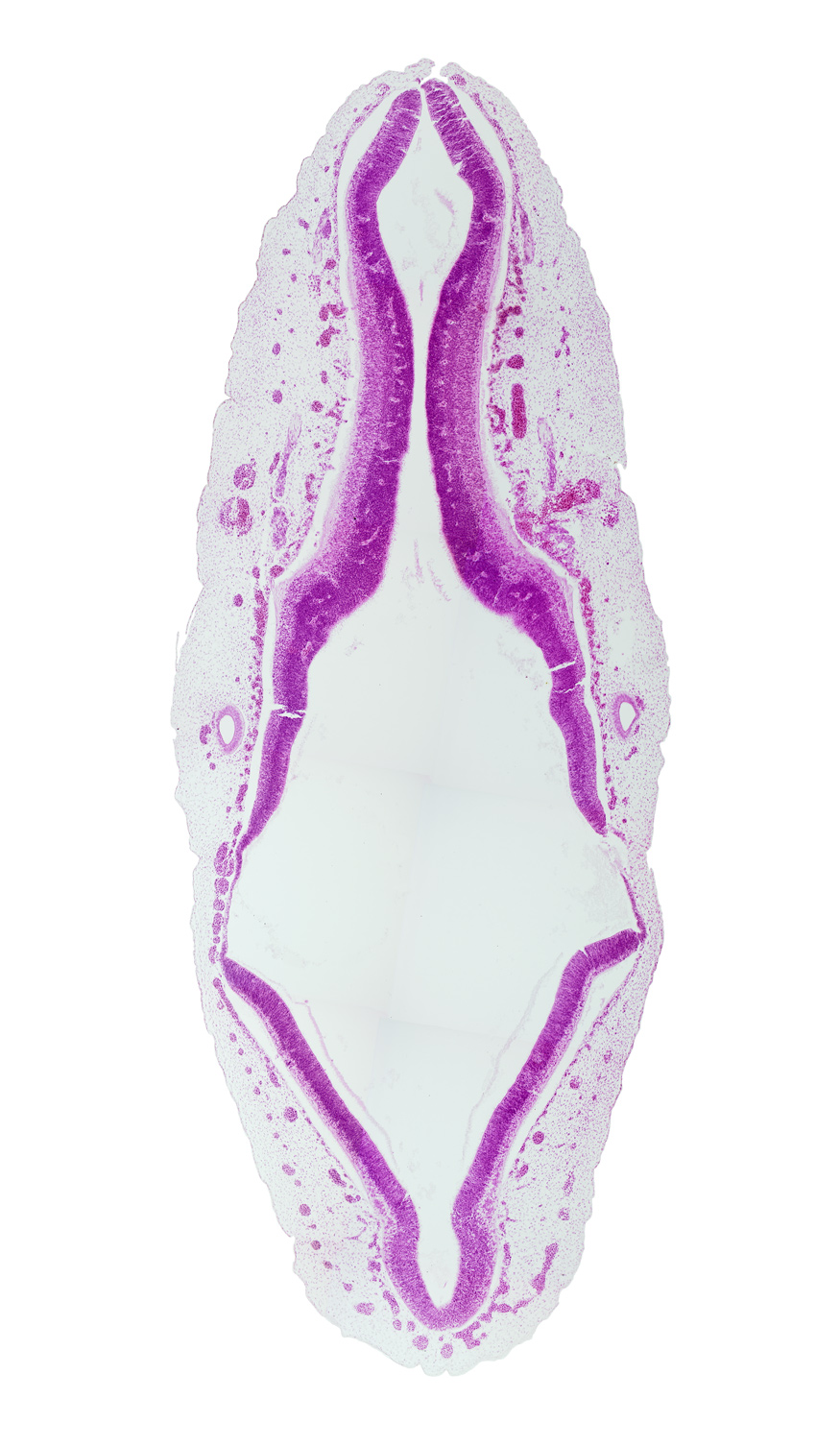alar plate of mesencephalon (M2), alar plate of rhombencephalon, alar plate of rhombencephalon (cerebellum), basal plate of rhombencephalon, endolymphatic duct, junction of mesencoel and rhombencoel (fourth ventricle), rhombencoel (fourth ventricle), root of vagus nerve (CN X), spinal accessory nerve (CN XI), sulcus limitans, vascular plexus