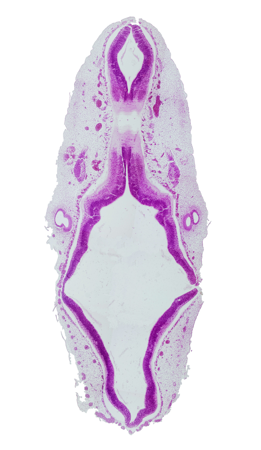 accessory nerve (CN XI), alar plate of mesencephalon, alar plate of metencephalon, alar plate of rhombencephalon, alar plate of rhombencephalon (cerebellum), anterior dural venous plexus, basal plate of rhombencephalon, intermediate zone, junction of alar plate and roof plate of rhombencephalon, junction of endolymphatic duct and vestibular part of otic vesicle, junction of mesencoel and rhombencoel (fourth ventricle), marginal zone, mesencoel (cerebral aqueduct), metencephalic artery (superior cerebellar), rhombencoel (fourth ventricle), roof plate of rhombencephalon, sulcus limitans, superior ganglion of vagus nerve (CN X), ventricular zone