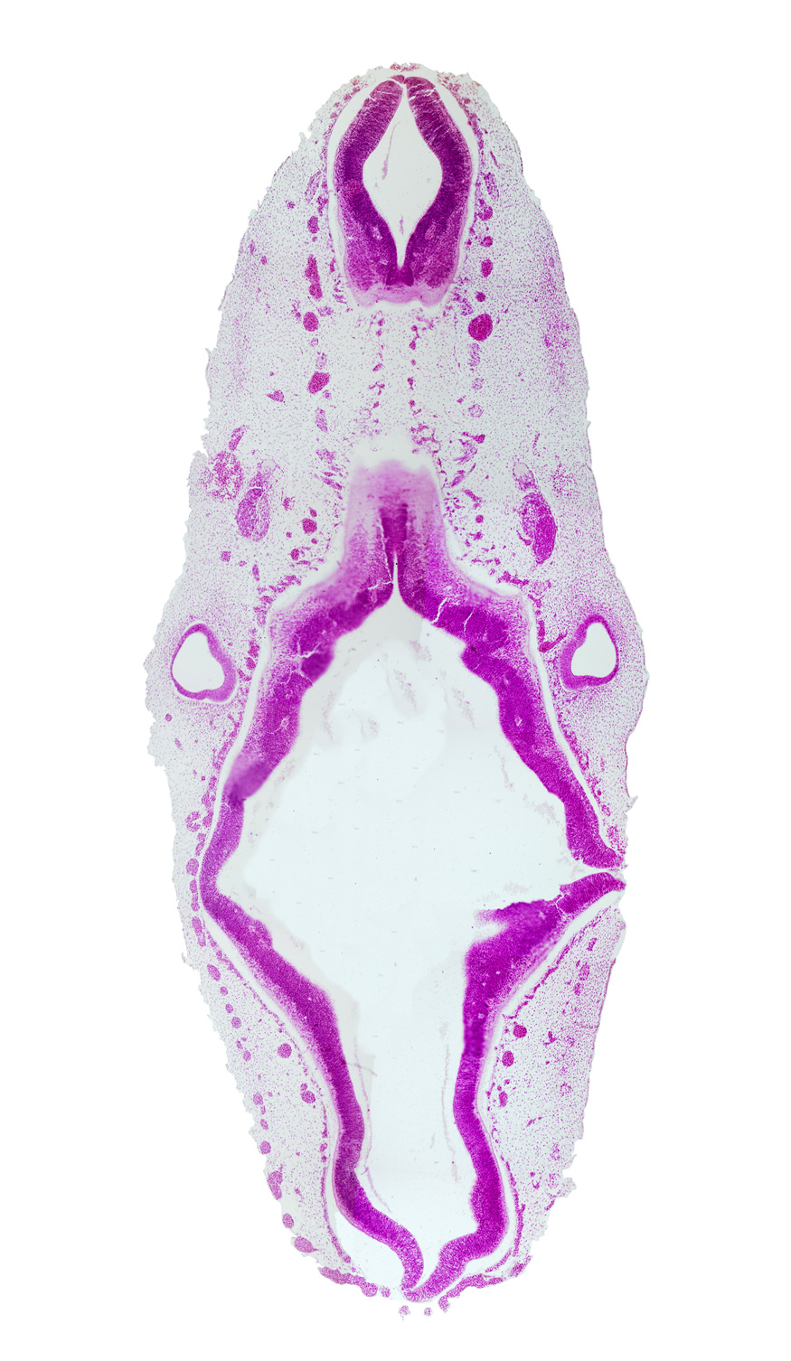anterior dural venous plexus, caudal part of rhombencephalon, intermediate zone, junction of endolymphatic duct and vestibular part of otic vesicle, marginal zone, mesencephalon (M2), mesencoel (cerebral aqueduct), metencephalic arteries, middle dural venous plexus, origin of glossopharyngeal nerve (CN IX), posterior dural venous plexus, rhombencoel (fourth ventricle), rhombomere 4, rhombomere 5, rhombomere 6, sulcus limitans, superior ganglion of vagus nerve (CN X), vascular plexus, ventricular zone