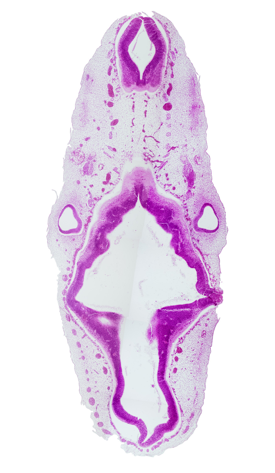 accessory nerve (CN XI), alar plate(s), anterior dural venous plexus, basal plate, floor plate, glossopharyngeal nerve (CN IX), intermediate zone, isthmus of rhombencephalon, marginal zone, mesencephalon (M2), metencephalic arteries, middle dural venous plexus, myelencephalic artery, posterior dural venous plexus, rhombomere 2, rhombomere 3, rhombomere 4, rhombomere 5, rhombomere 6, roof plate, root of hypoglossal nerve (CN XII), sulcus limitans, superior ganglion of vagus nerve (CN X), ventricular zone, vestibular part of otic vesicle