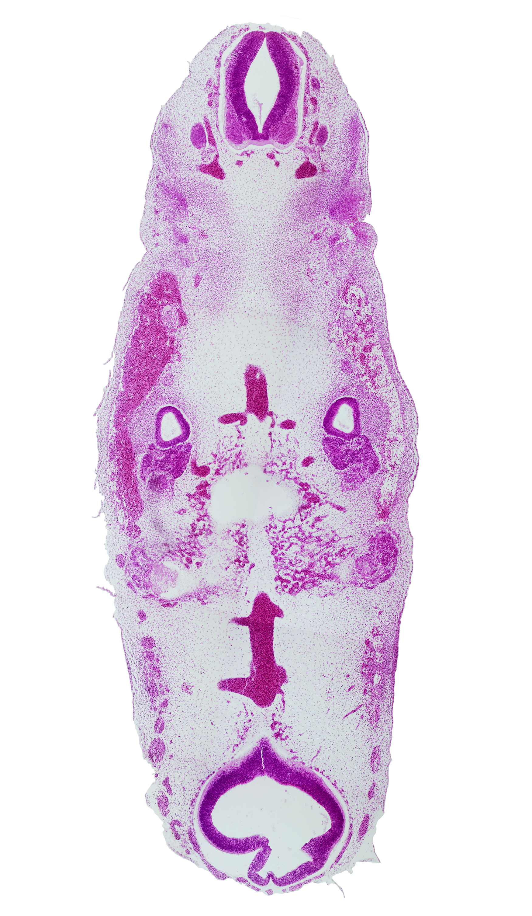 C-1 / C-2 interganglion region, anterior dural venous plexus, anterior spinal artery, basilar artery, cochlear part of otic vesicle, facial nerve (CN VII), glossopharyngeal nerve (CN IX), intersegmental artery, mesencephalon (M2), mesencoel (cerebral aqueduct), otic capsule, parachordal condensation, primary head vein, sulcus limitans, trigeminal ganglion (CN V), vascular plexus, vertebral artery, vestibulocochlear ganglion (CN VIII)