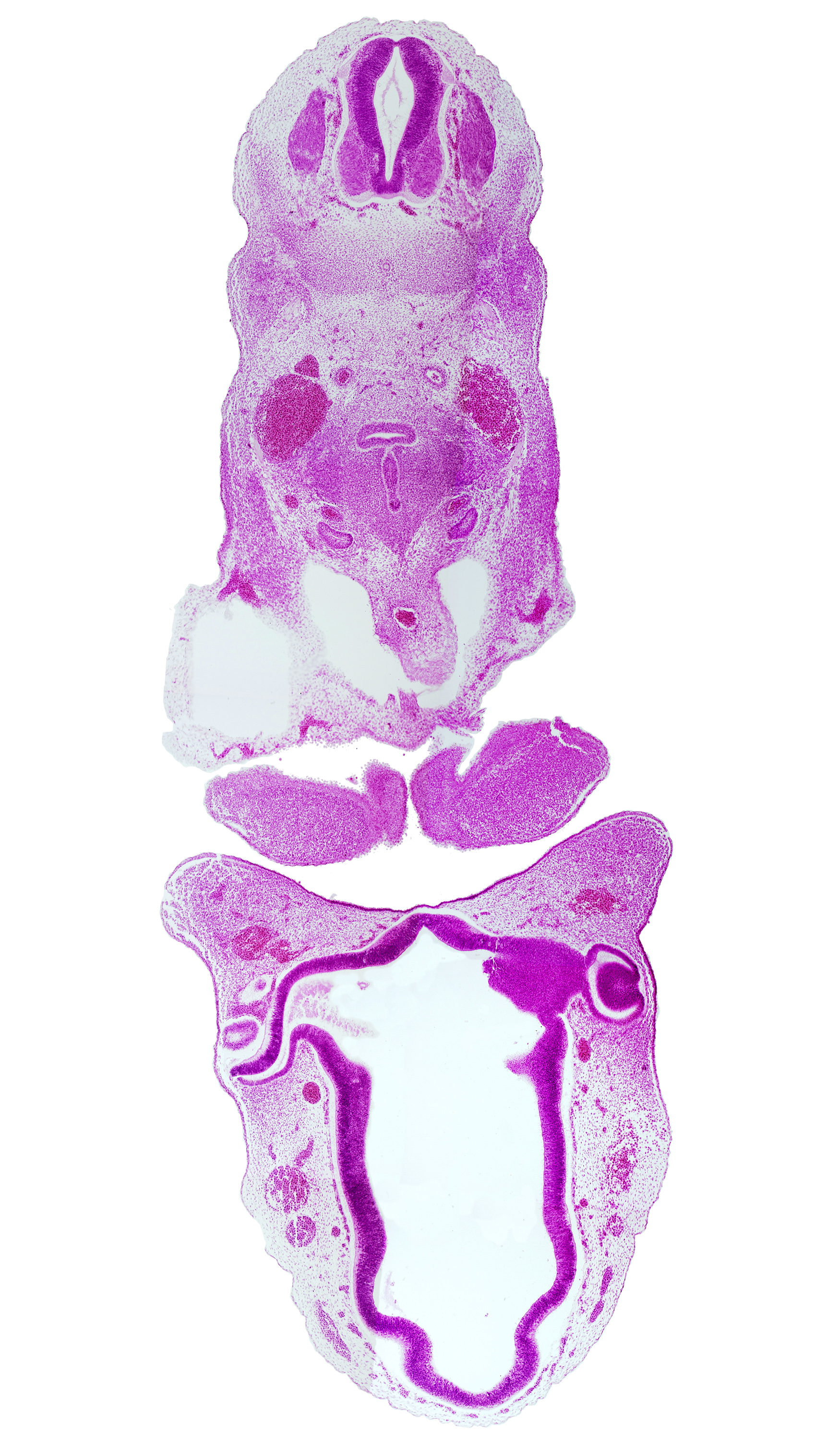 C-4 spinal ganglion, anterior dural venous plexus, aortic sac, caudal edge of ultimopharyngeal pouch, dorsal aorta, dorsal thalamus, lens vesicle, mandibular prominence of pharyngeal arch 1, maxillary prominence of pharyngeal arch 1, median mandibular groove, notochord, optic chiasma (chiasmatic plate), optic stalk (CN II), oronasal cavity, pericardial cavity, precardinal vein (internal jugular vein), primordial olfactory artery, pulmonary arch, synencephalon, third ventricle, ventral thalamus