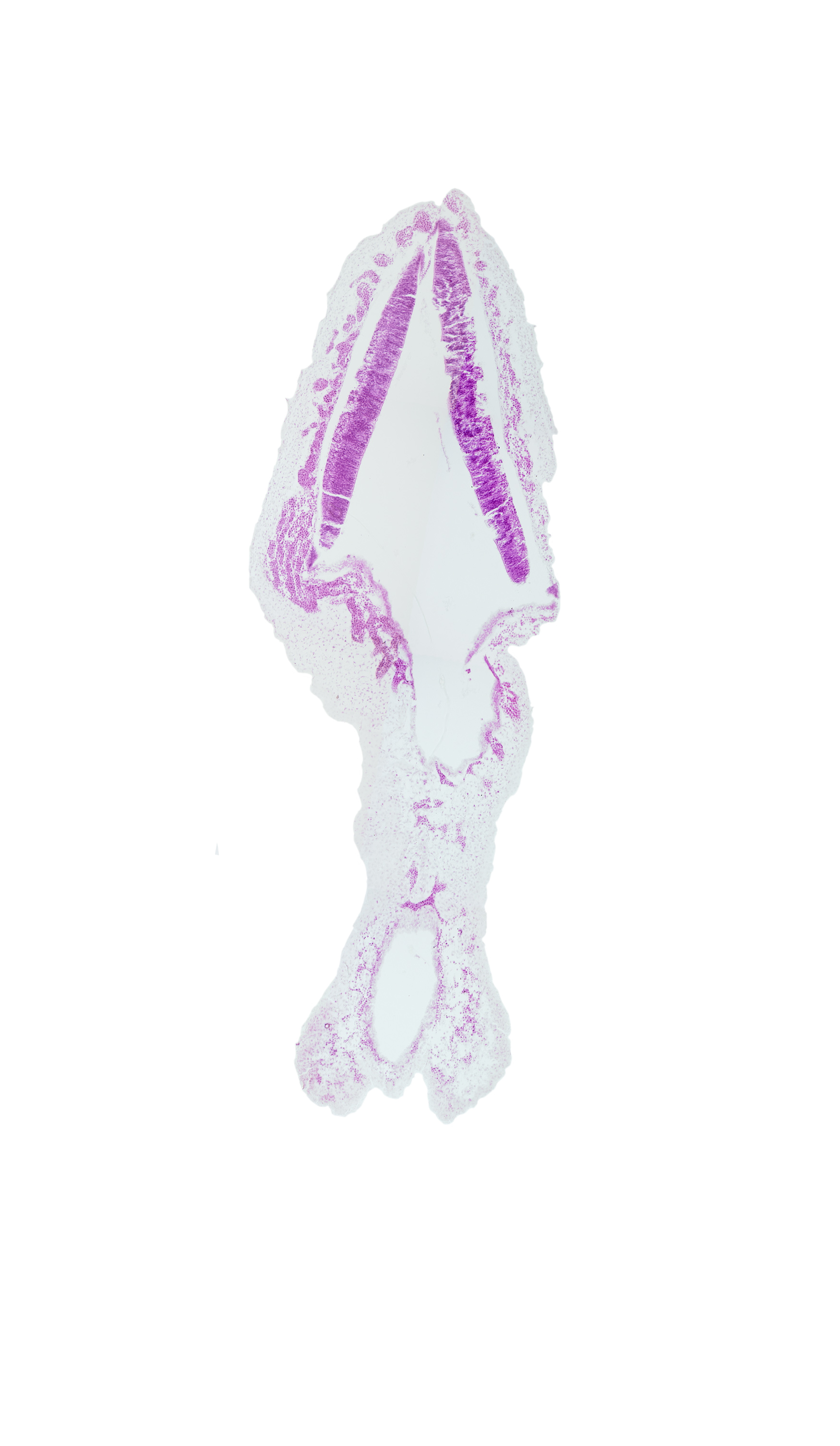 alar plate of rhombencephalon (cerebellum), cephalic edge of rhombencoel (fourth ventricle), rhombencoel (fourth ventricle), roof plate of rhombencephalon, surface ectoderm, vascular plexus