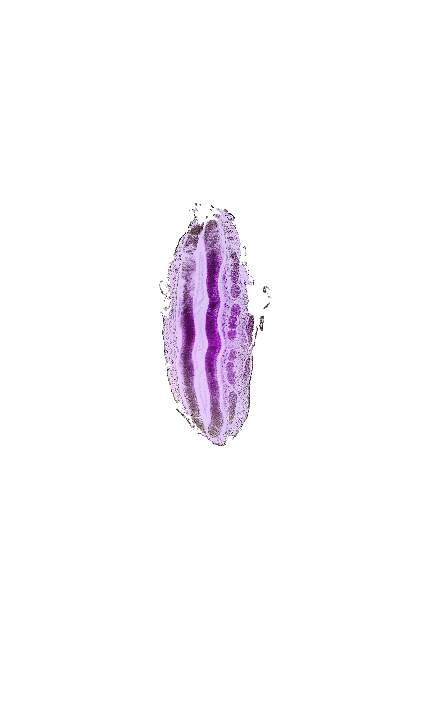 L-3 spinal ganglion, L-4 spinal ganglion, L-5 spinal ganglion, S-1 spinal ganglion, central canal, surface ectoderm