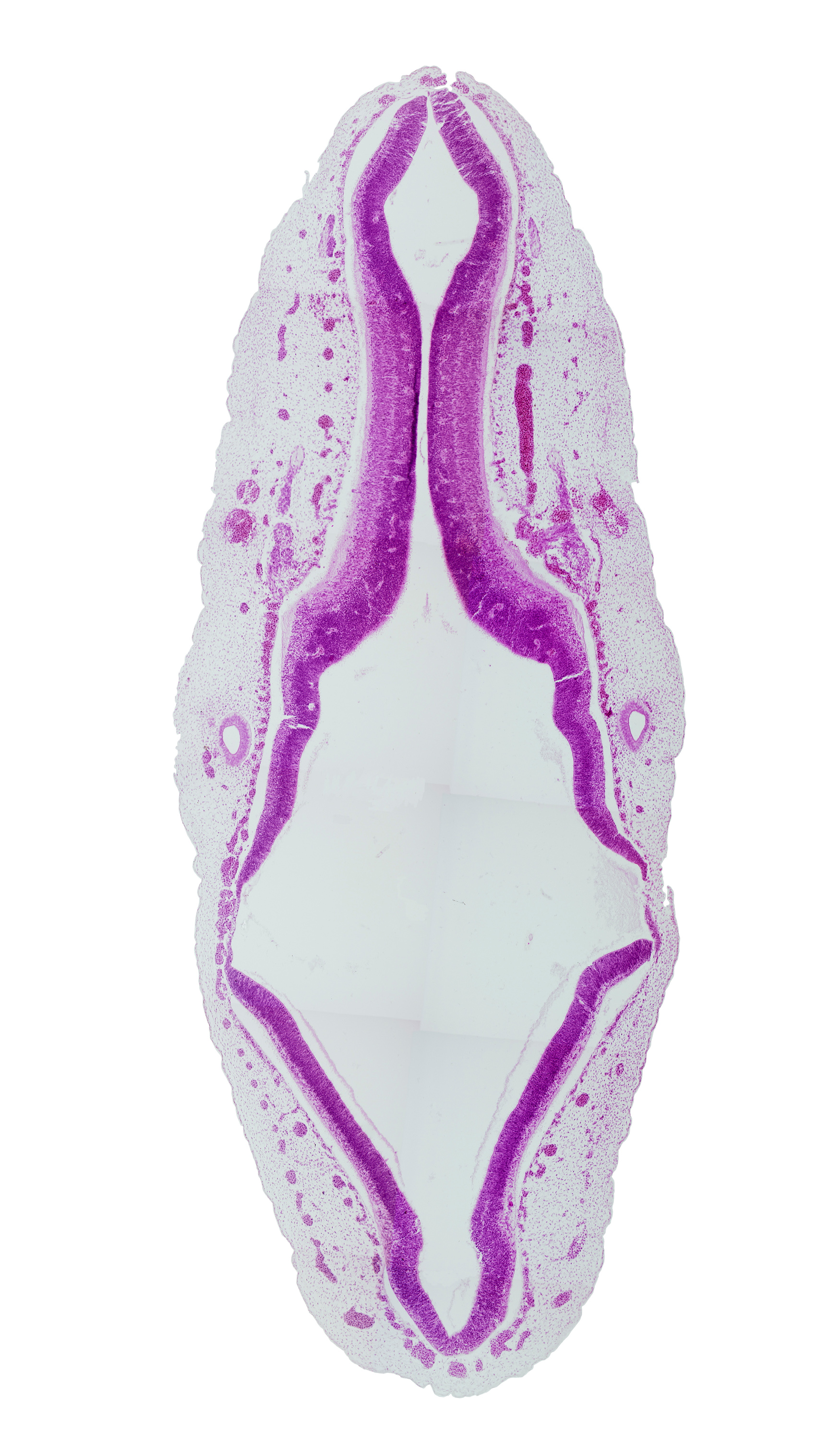 alar plate of mesencephalon (M2), alar plate of rhombencephalon, alar plate of rhombencephalon (cerebellum), basal plate of rhombencephalon, cranial accessory nerve (CN XI), endolymphatic duct, posterior dural venous plexus, rhombencoel (fourth ventricle), roof plate of rhombencephalon, spinal accessory nerve (CN XI), sulcus limitans, vagus nerve (CN X)