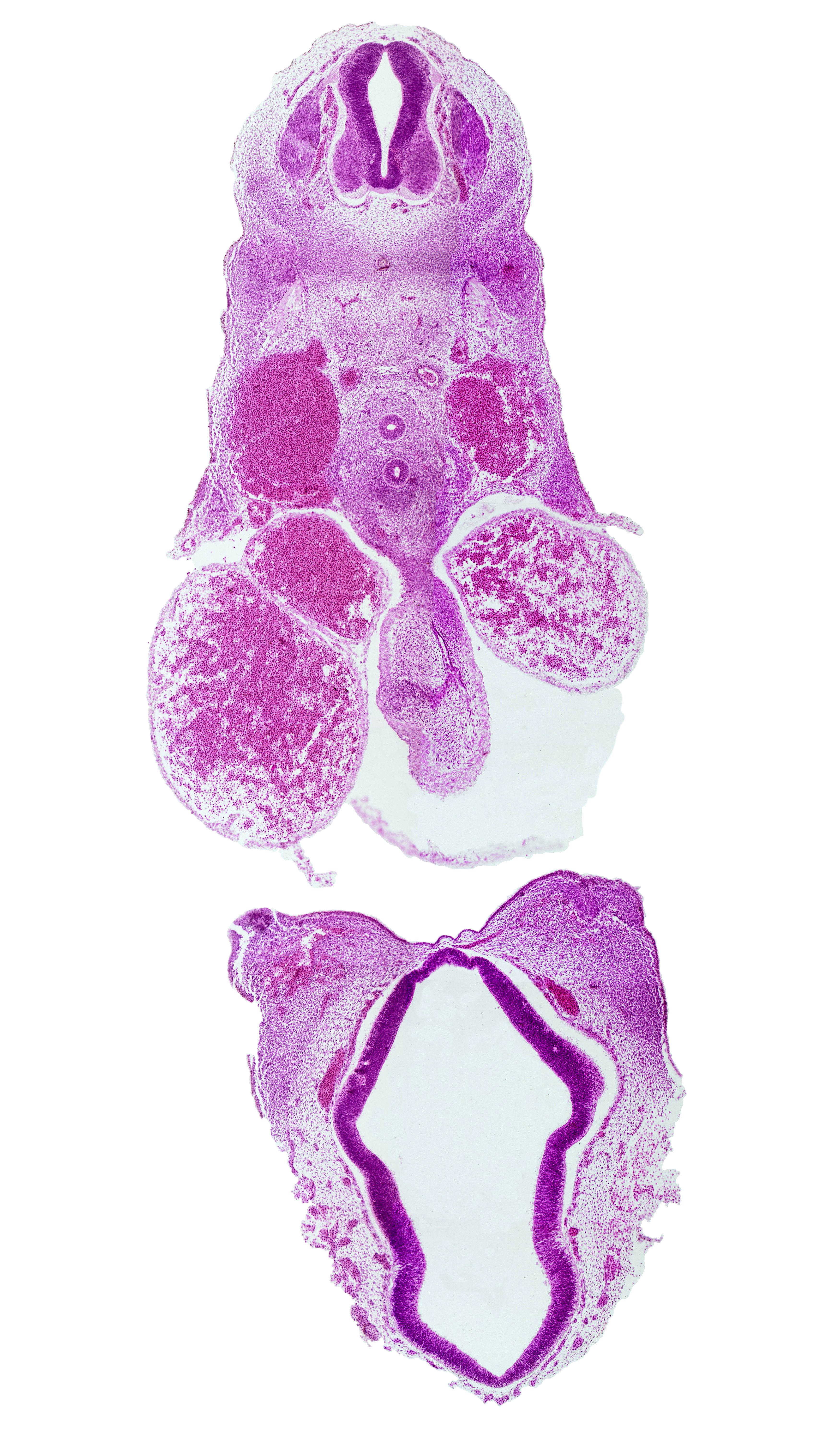 C-5 spinal ganglion, caudal edge of lateral ventricle, disrupted pericardial sac, dorsal aorta, dorsal thalamus, esophagus, junction of maxillary and medial nasal prominences, left atrium, notochord, primordial olfactory artery, right atrium, third ventricle, trachea, ventral thalamus