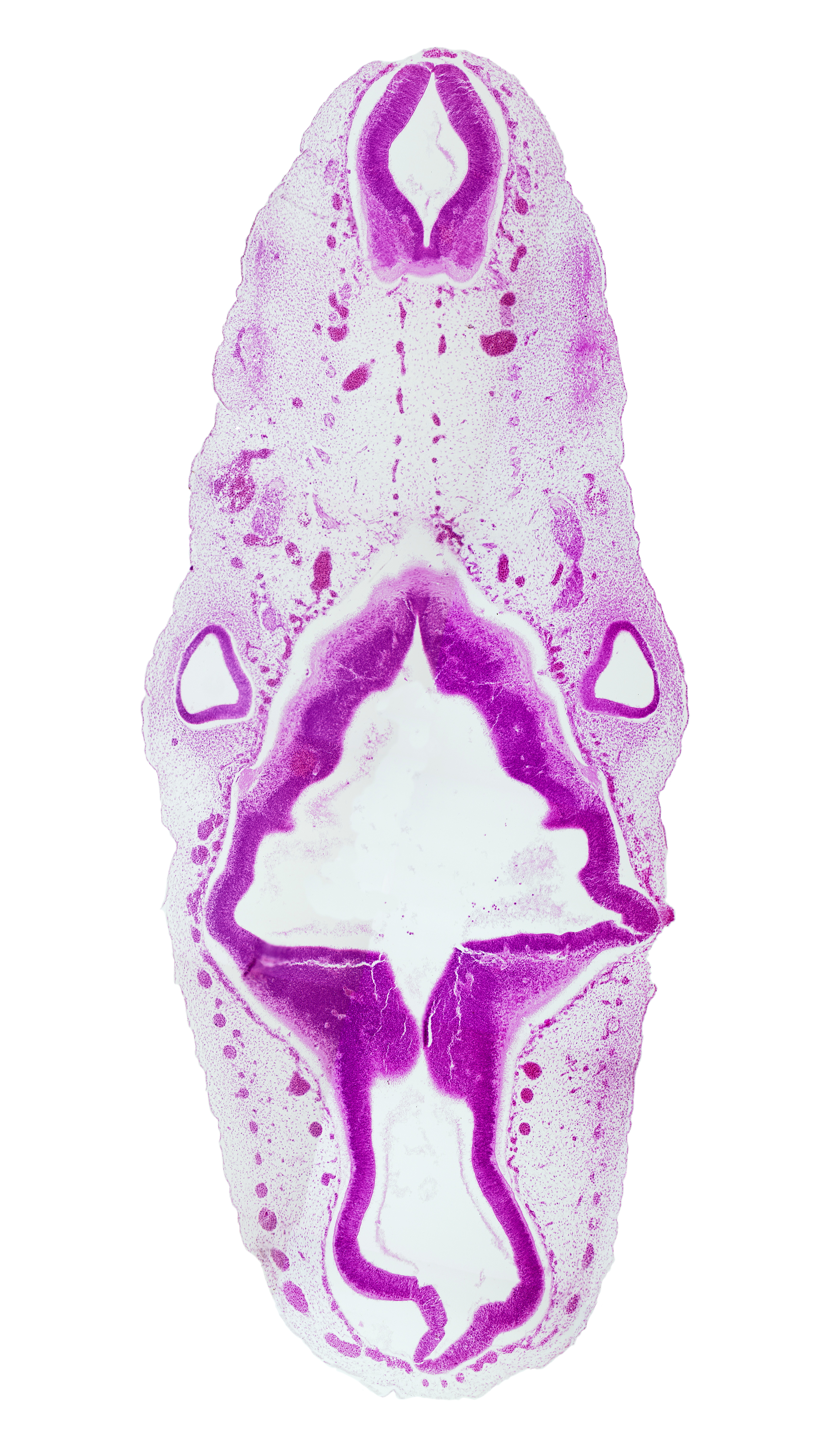 accessory nerve (CN XI), anterior dural venous plexus, basal plate, caudal part of rhombencephalon, isthmus of rhombencephalon, mesencephalon (M2) (partly collapsed), mesencoel (cerebral aqueduct), middle dural venous plexus, myelencephalic artery, posterior dural venous plexus, rhombencoel (fourth ventricle), rhombomere 1, rhombomere 2, rhombomere 3, rhombomere 4, rhombomere 5, root of hypoglossal nerve (CN XII), sulcus limitans, superior ganglion of glossopharyngeal nerve (CN IX), tectum, tegmentum, vagus nerve (CN X), vascular plexus
