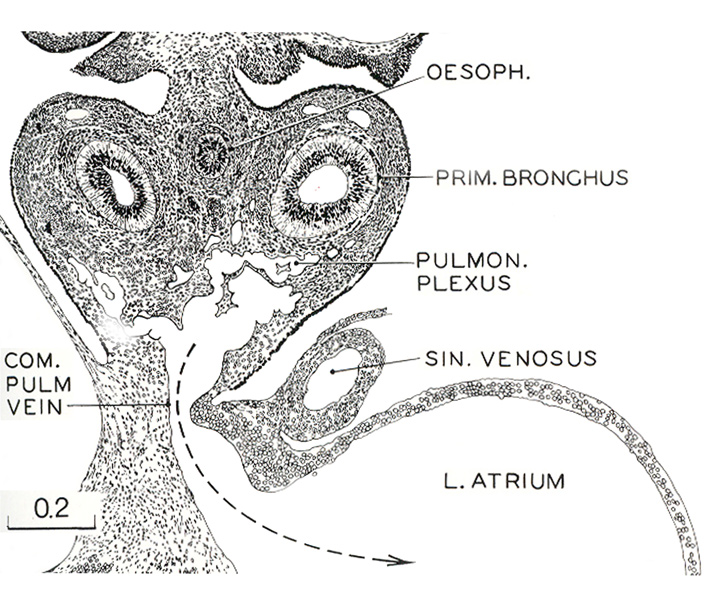 Mesenchymal tissue in the pulmonary and esophageal regions - Drawing