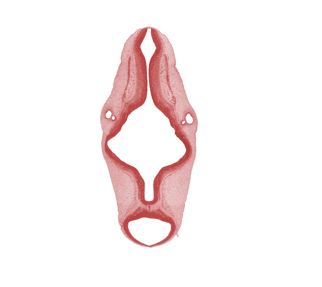 accessory nerve (CN XI), artifact separation(s), central canal of myelencephalon, endolymphatic duct, intermediate zone, junction of central canal and rhombencoel (fourth ventricle), marginal zone, mesencoel (cerebral aqueduct), otic capsule, rhombencoel (fourth ventricle), rhombomere 4, rhombomere 5, rhombomere 6, rhombomere 7, sulcus limitans, ventricular zone