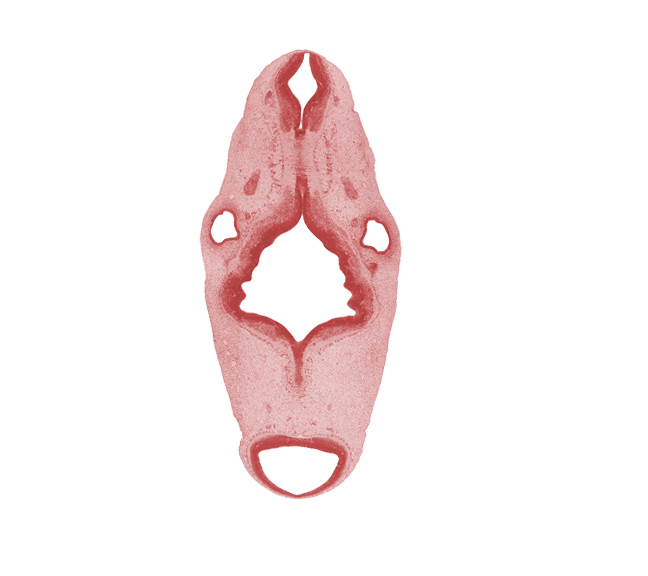 central canal, intermediate zone, marginal zone, median sulcus, mesencoel (cerebral aqueduct), myelencephalon, region of mesencephalic (cephalic) flexure, rhombencoel (fourth ventricle), rhombomere 2, rhombomere 3, rhombomere 4, rhombomere 5, rhombomere 6, root of facial nerve (CN VII), root of hypoglossal nerve (CN XII), root of vestibulocochlear nerve (CN VIII), sulcus limitans, tectum, tegmentum, trochlear nerve (CN IV), ventricular zone