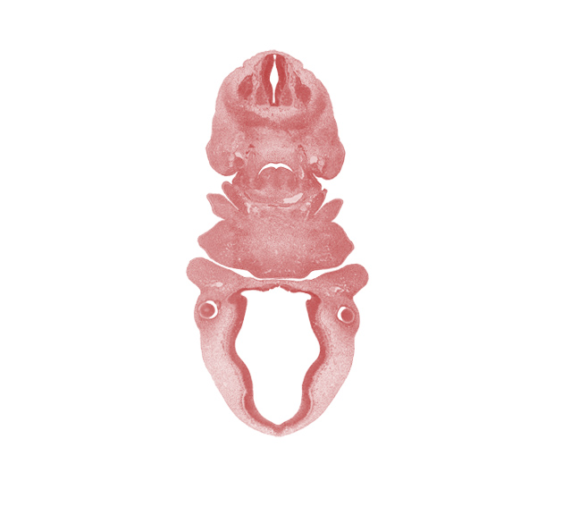 C-3 spinal ganglion, aortic arch 4, bilobed thyroid gland, caudal edge of pharyngeal arch 3, caudal edge of pharyngeal arch 4, cervical sinus, condensation around optic cup, dense caudal part of sclerotome, epithalamus, horn of aortic sac, intermediate zone, mandibular prominence of pharyngeal arch 1, marginal zone, maxillary prominence of pharyngeal arch 1, maxillary vein, medial eminence, oral fissure, oronasal cavity, pharyngeal arch 2, pineal bud, surface ectoderm, sympathetic trunk, ventricular zone