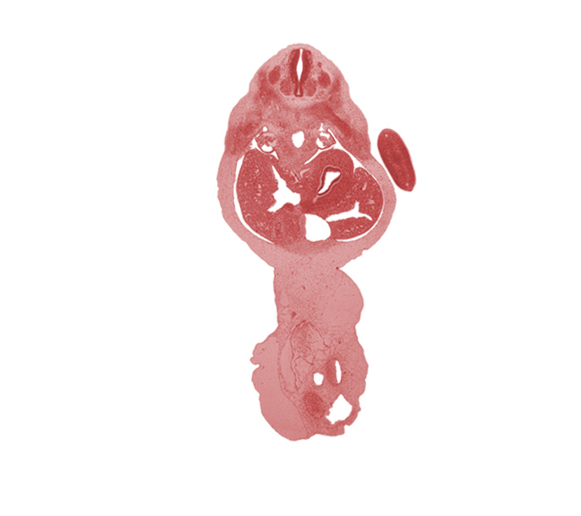 T-1 dorsal root, T-2 spinal ganglion, T-2 ventral root, T-3 intercostal nerve, afferent hepatic vein, aorta, blastema of rib 3, cystic duct, dorsal mesogastrium, ductus venosus, gall bladder, left lobe of liver, mesonephros, right lobe of liver, stomach, sympathetic trunk