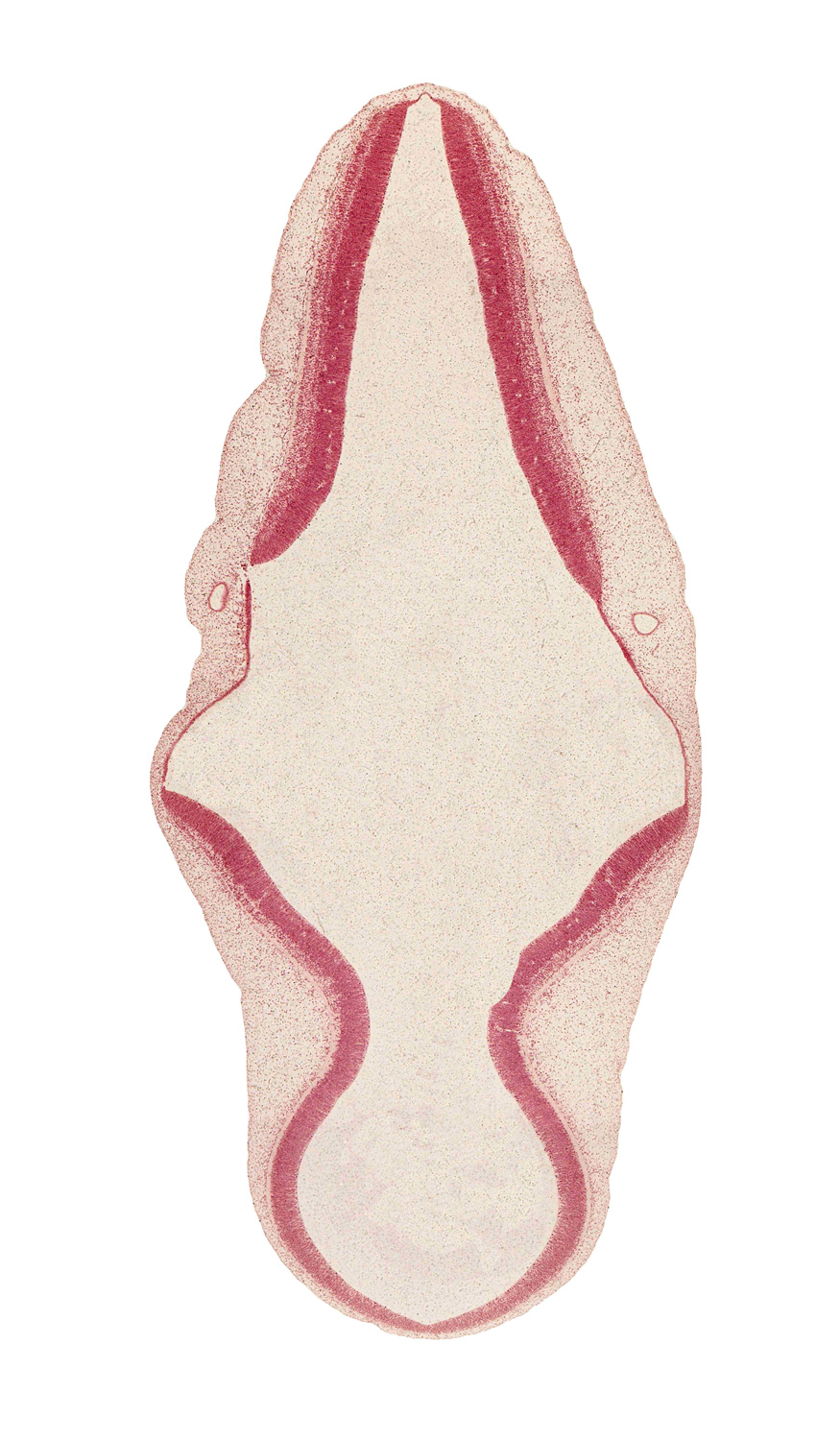 alar plate(s), artifact separation(s), basal plate, endolymphatic duct, rhombencoel (fourth ventricle), roof plate, sulcus limitans, surface ectoderm, tectum, tegmentum