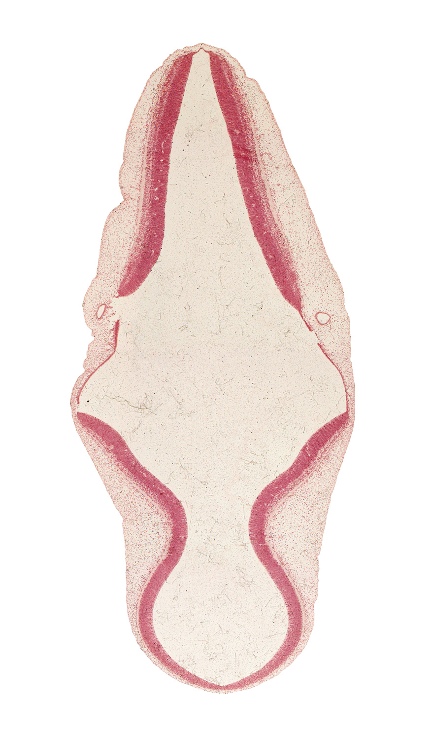 artifact separation(s), intermediate zone, marginal zone, mesencephalon (M2), metencephalon, myelencephalon, ventricular zone