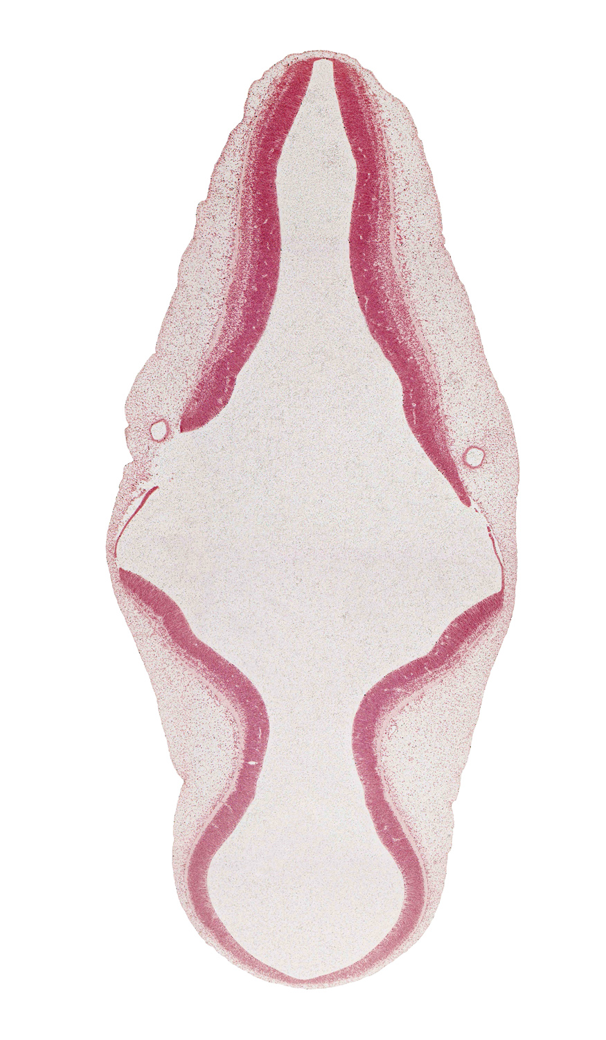 alar plate of metencephalon (cerebellum), artifact separation(s), basal plate, endolymphatic duct, head mesenchyme, intermediate zone, marginal zone, mesencephalon (M2), myelencephalon, rhombencoel (fourth ventricle), roof plate, sulcus limitans, surface ectoderm, trochlear nerve (CN IV), ventricular zone