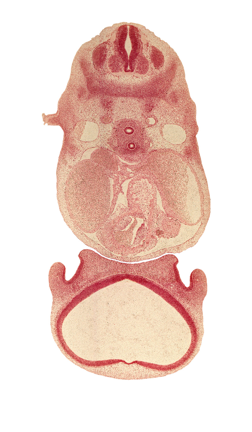 C-5 spinal ganglion, aortic vestibule of left ventricle, cephalic edge of upper limb, cornu Ammonis, dense caudal part of sclerotome, dorsal aorta, esophagus, gyrus dentatus, head mesenchyme, infundibulum of right ventricle, lateral nasal prominence, medial nasal prominence(s), nasal capsule, pericardial cavity, phrenic nerve, region of olfactory filia (CN I), sympathetic trunk, telencephalon medium, trachea, transverse sinus, tuberculum olfactorium, vagus nerve (CN X)