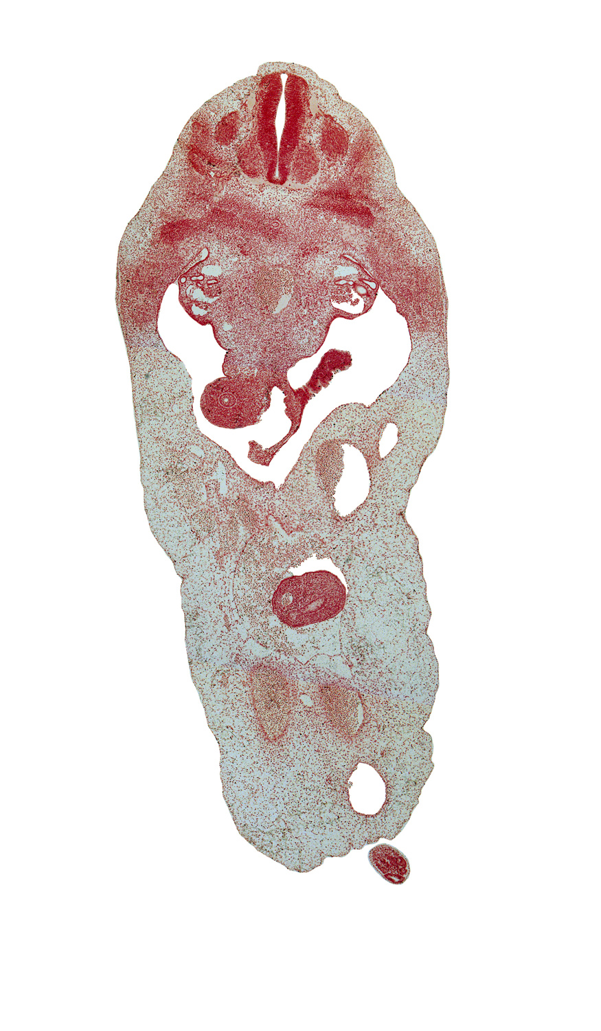 T-4 spinal ganglion, aorta, blastema of rib 5, caudal eminence, dorsal fasciculus, duodenum (endoderm), intermediate zone, marginal zone, mesenchymal condensation around hindgut, midpoint of herniated midgut, peritoneal cavity, postcardinal vein, subcardinal vein, superior mesenteric vein, umbilical coelom, umbilical cord, ventricular zone