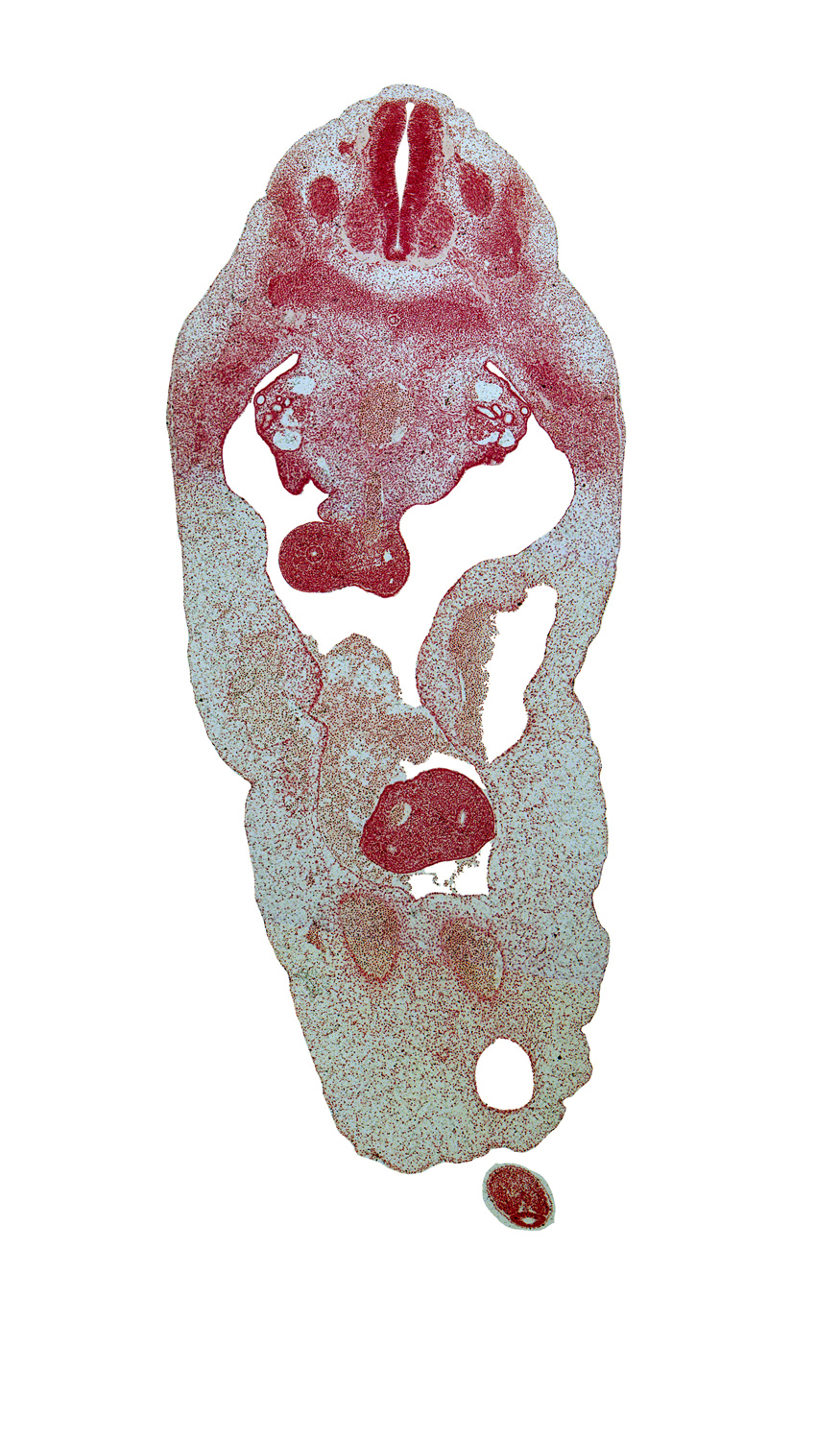 T-4 spinal ganglion, T-5 spinal nerve, aorta, blastema of rib 6, distal limb of herniated midgut, duodenum, junction of peritoneal cavity and umbilical coelom, left umbilical artery, mesonephric duct, mesonephric tubule(s), proximal limb of herniated midgut, right umbilical artery, superior mesenteric vein, superior mesenteric vessels, umbilical cord, umbilical vein