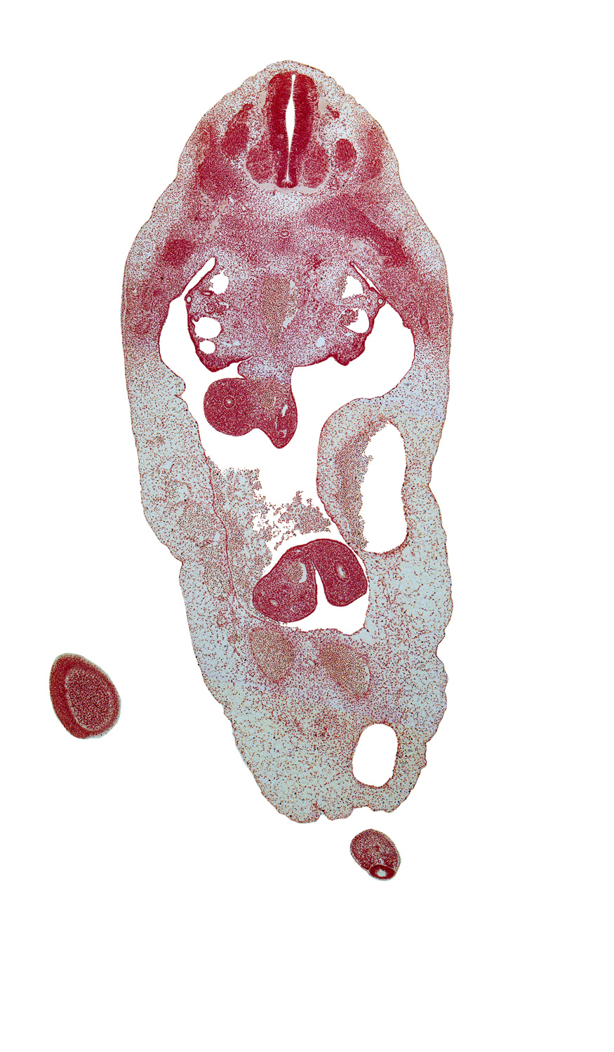 T-4 dorsal root, T-5 spinal ganglion, T-5 ventral root, aorta, blastema of rib 6, dorsal mesentery, duodenum, gonadal ridge, lower limb, neural arch, postcardinal vein, primordial filum terminale, primordial meninx, subcardinal vein, superior mesenteric artery, superior mesenteric vein, umbilical coelom, umbilical cord