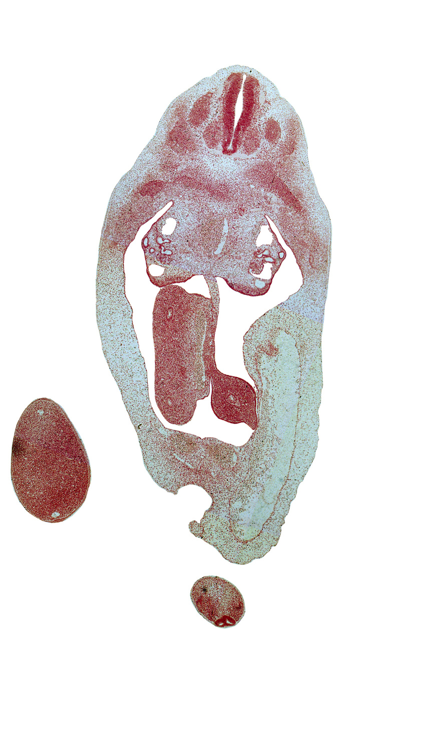 T-6 spinal ganglion, abdominal wall mesenchyme, aorta, blastema of rib 7, caudal eminence, distal limb of herniated midgut, gonadal ridge, leg, mesonephric duct, postcardinal vein, primordial meninx, proximal limb of herniated midgut, umbilical cord, umbilical vein