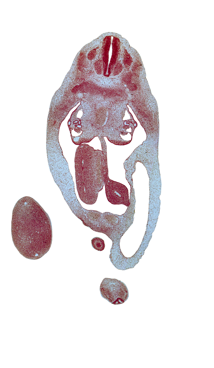 T-6 spinal ganglion, T-7 spinal nerve, aorta, blastema of rib 7, blastema of rib 8, caudal eminence, cecum endoderm, edge of genital tubercle, gonadal ridge, left umbilical artery, marginal vein, mesonephric duct, postcardinal vein, primordial filum terminale, proximal limb of herniated midgut endoderm, right umbilical artery, umbilical cord, umbilical vein