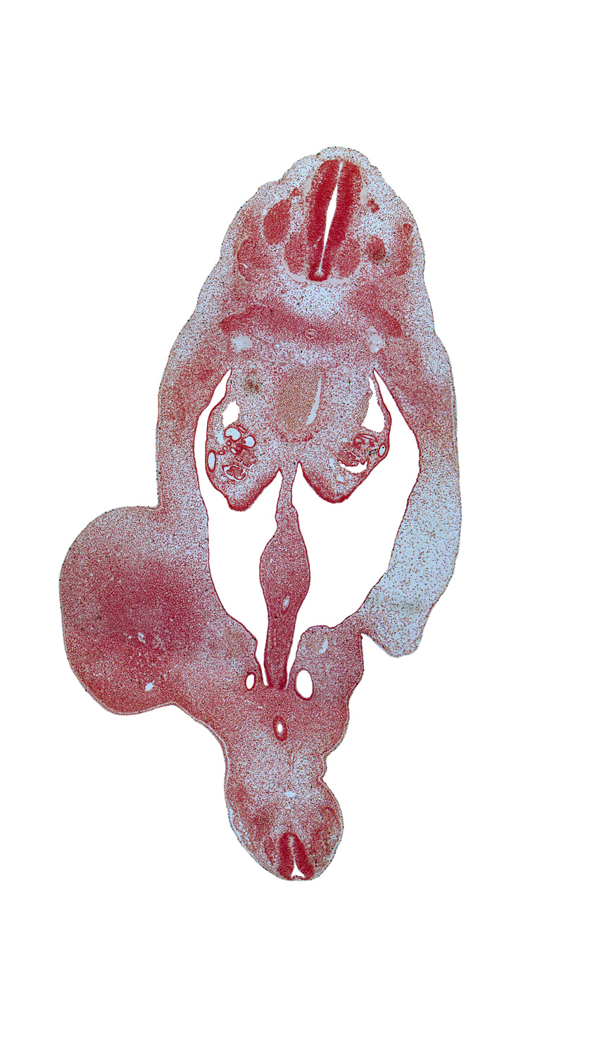T-7 spinal ganglion, T-8 spinal ganglion, aorta, blastema of rib 9, coccygeal mesoderm, dorsal mesentery, gonadal ridge, hindgut, horn of urogenital sinus, mesonephric duct, notochord, peritoneal cavity, postcardinal vein, rectum