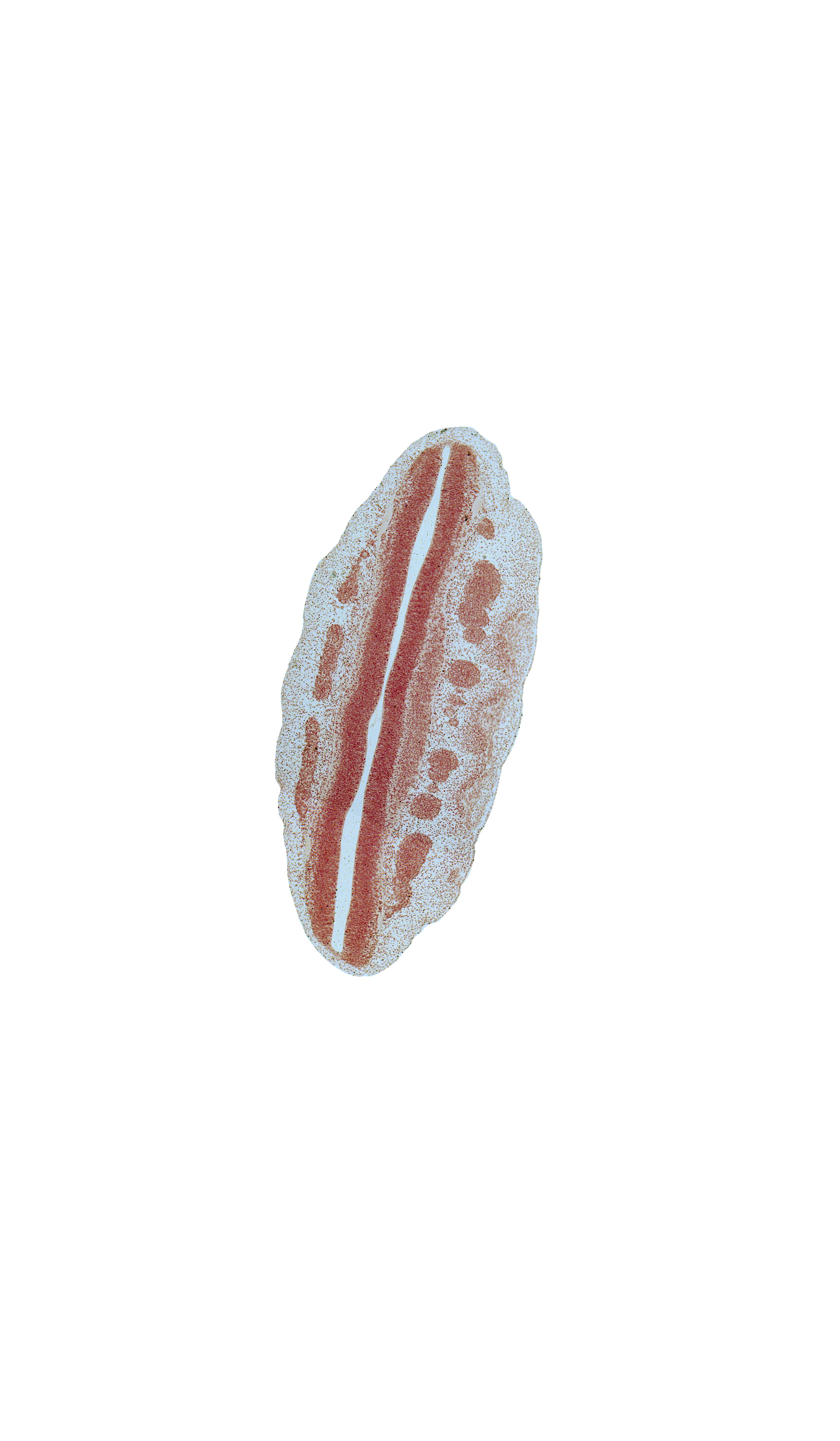 L-1 spinal ganglion, L-2 spinal ganglion, L-3 spinal ganglion, L-4 spinal ganglion, L-5 spinal ganglion, alar plate(s), dorsal root(s), primordial meninx