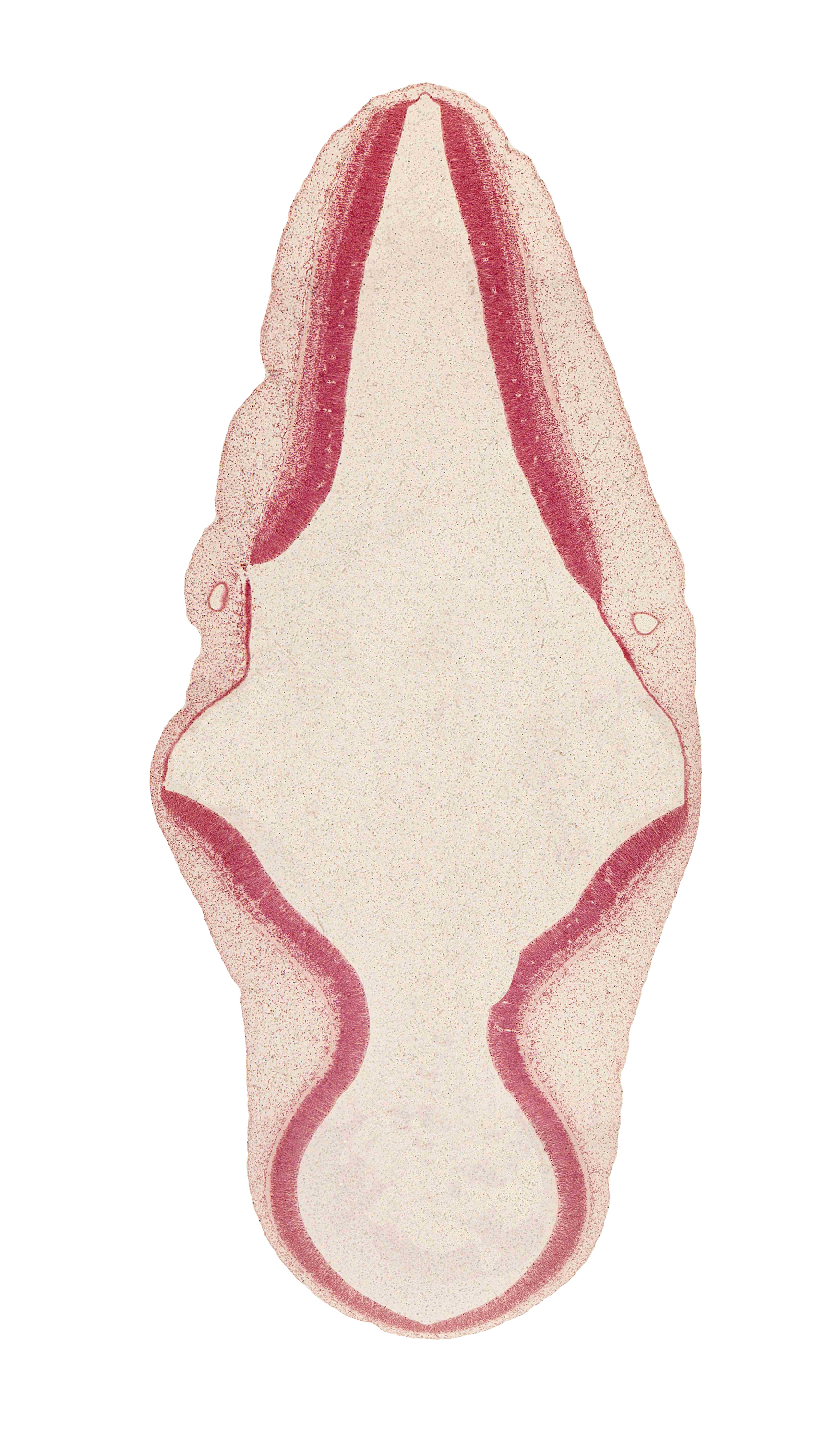 alar plate(s), artifact separation(s), basal plate, endolymphatic duct, rhombencoel (fourth ventricle), roof plate, sulcus limitans, surface ectoderm, tectum, tegmentum