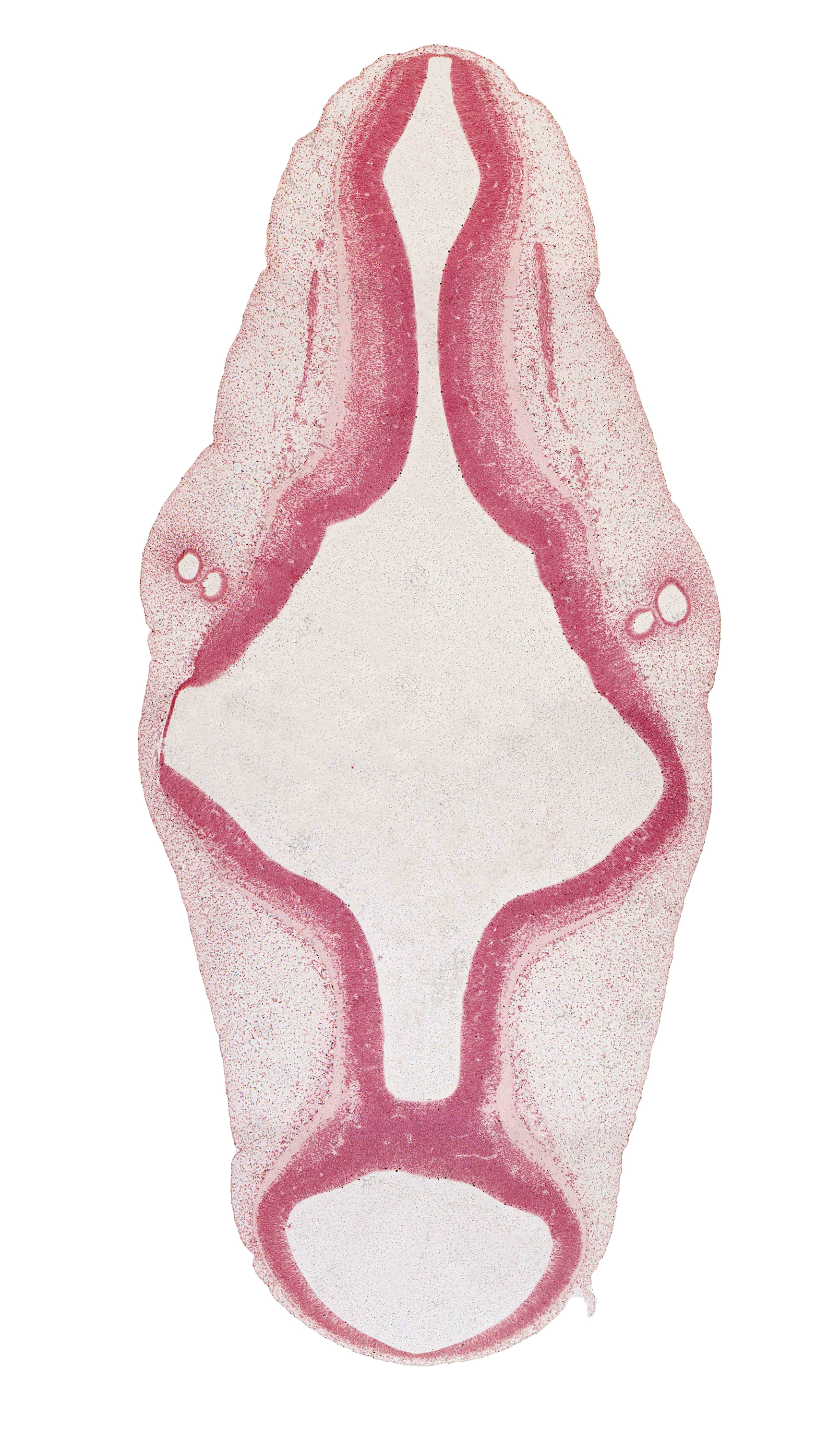accessory nerve (CN XI), alar plate of metencephalon (cerebellum), alar plate(s), artifact separation(s), basal plate, cephalic edge of vagus nerve (CN X), intermediate zone, isthmus of rhombencephalon, marginal zone, mesencephalon (M2), mesencoel (cerebral aqueduct), metencephalon, myelencephalon, otic capsule, rhombencoel (fourth ventricle), rhombomere 5, rhombomere 6, roof plate, sulcus limitans, trochlear nerve (CN IV), ventricular zone