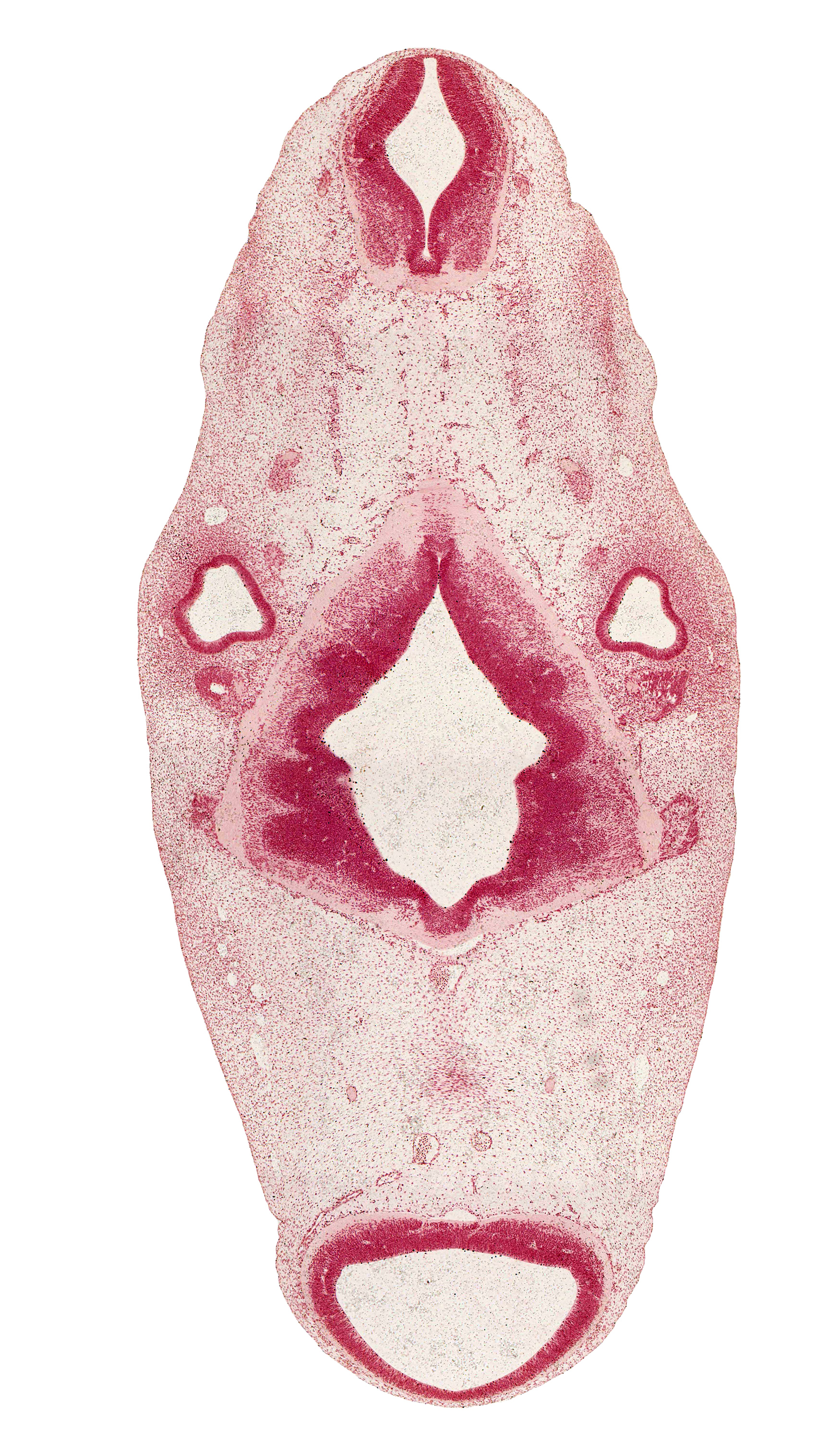 accessory nerve (CN XI), alar plate(s), anterior dural venous plexus, basal plate, basilar artery, central canal of myelencephalon, cephalic edge of diencephalon, cephalic edge of trigeminal ganglion (CN V), facial nerve (CN VII), floor plate, junction of vertebral arteries, mesencephalon (M1), mesencoel (cerebral aqueduct), occipital myotome, oculomotor nerve (CN III), posterior cerebral artery, rhombencoel (fourth ventricle), rhombomere 1, rhombomere 3, rhombomere 4, rhombomere 5, roof plate, root of trigeminal nerve (CN V), sulcus limitans, superior ganglion of glossopharyngeal nerve (CN IX), trochlear nerve (CN IV), vagus nerve (CN X), vestibulocochlear nerve (CN VIII)