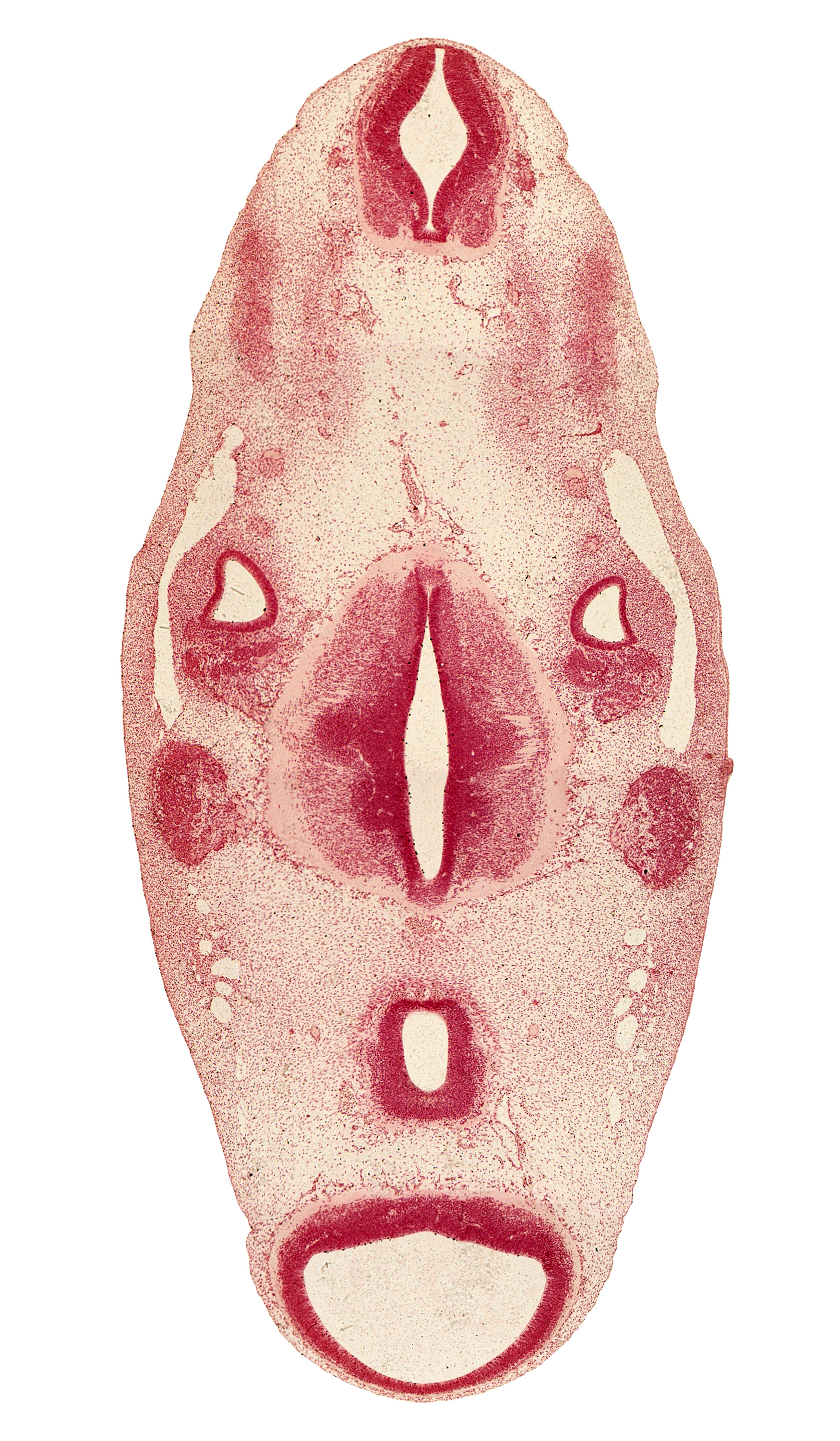 accessory nerve (CN XI), alar plate(s), anterior dural venous plexus, basal plate, cerebral peduncle, cochlear ganglion (CN VIII), cochlear part of otic vesicle, diencephalon, floor plate, glossopharyngeal nerve (CN IX), intermediate zone, marginal zone, median sulcus, mesencoel (cerebral aqueduct), oculomotor nerve (CN III), primary head vein, rhombomere 4, roof plate, root of hypoglossal nerve (CN XII), sulcus limitans, tectum, tegmentum, trigeminal ganglion (CN V), trochlear nerve (CN IV), ventricular zone