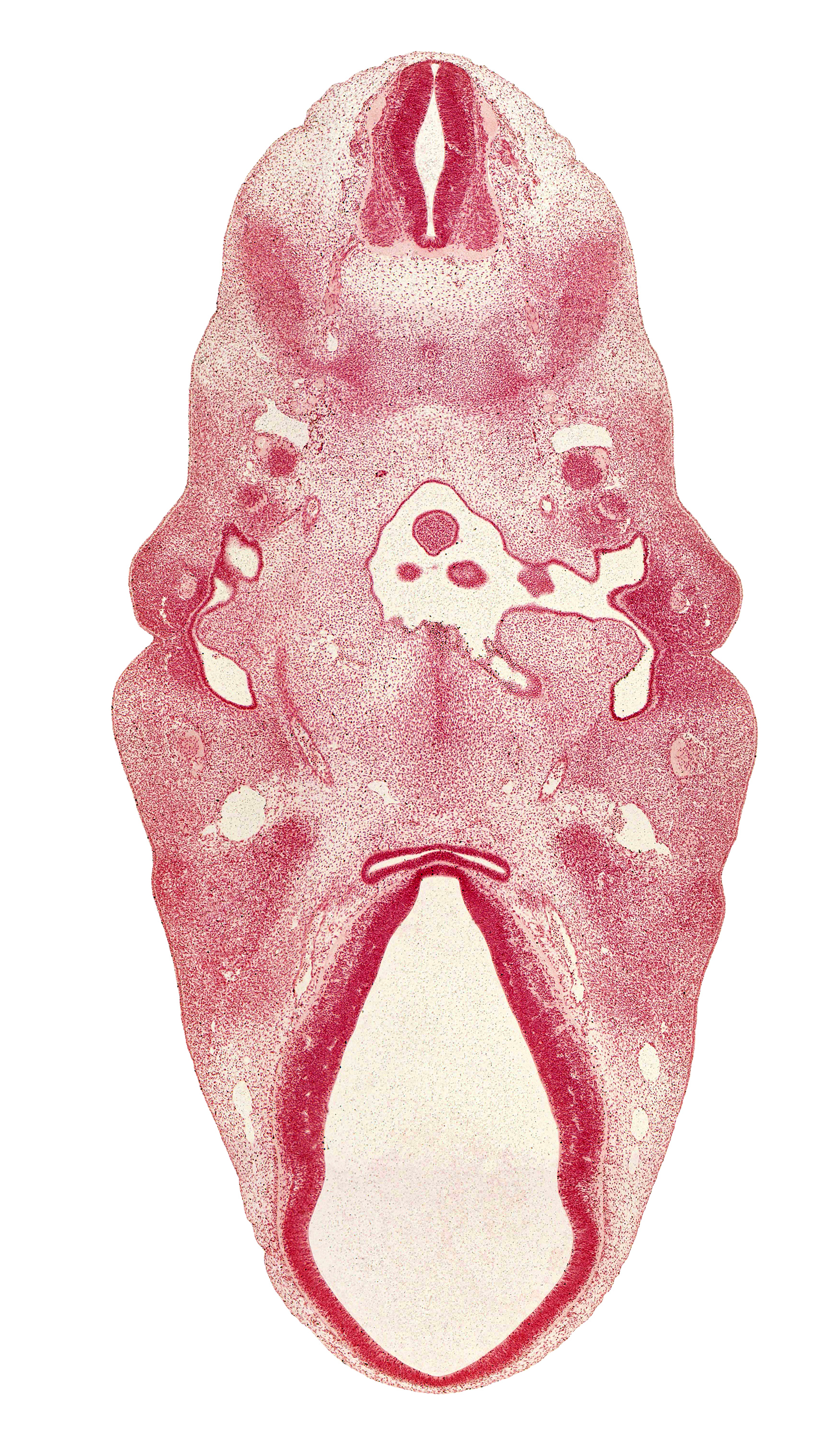 C-2 spinal ganglion, adenohypophysial pouch, anterior dural venous plexus, dorsal root(s), dorsal sulcus, facial nerve (CN VII), glossopharyngeal nerve (CN IX), hypopharyngeal eminence of tongue, inferior ganglion of vagus nerve (CN X), intermediate zone, internal carotid artery, junction of internal carotid and posterior communicating arteries, mandibular nerve (CN V₃), marginal zone, middle sulcus, myotome, neurohypophyseal bud, pharyngeal groove 1, pharynx, precardinal vein, sclerotome, spinal accessory nerve (CN XI), tuberculum impar of tongue, ventral (hypothalamic) sulcus, ventricular zone