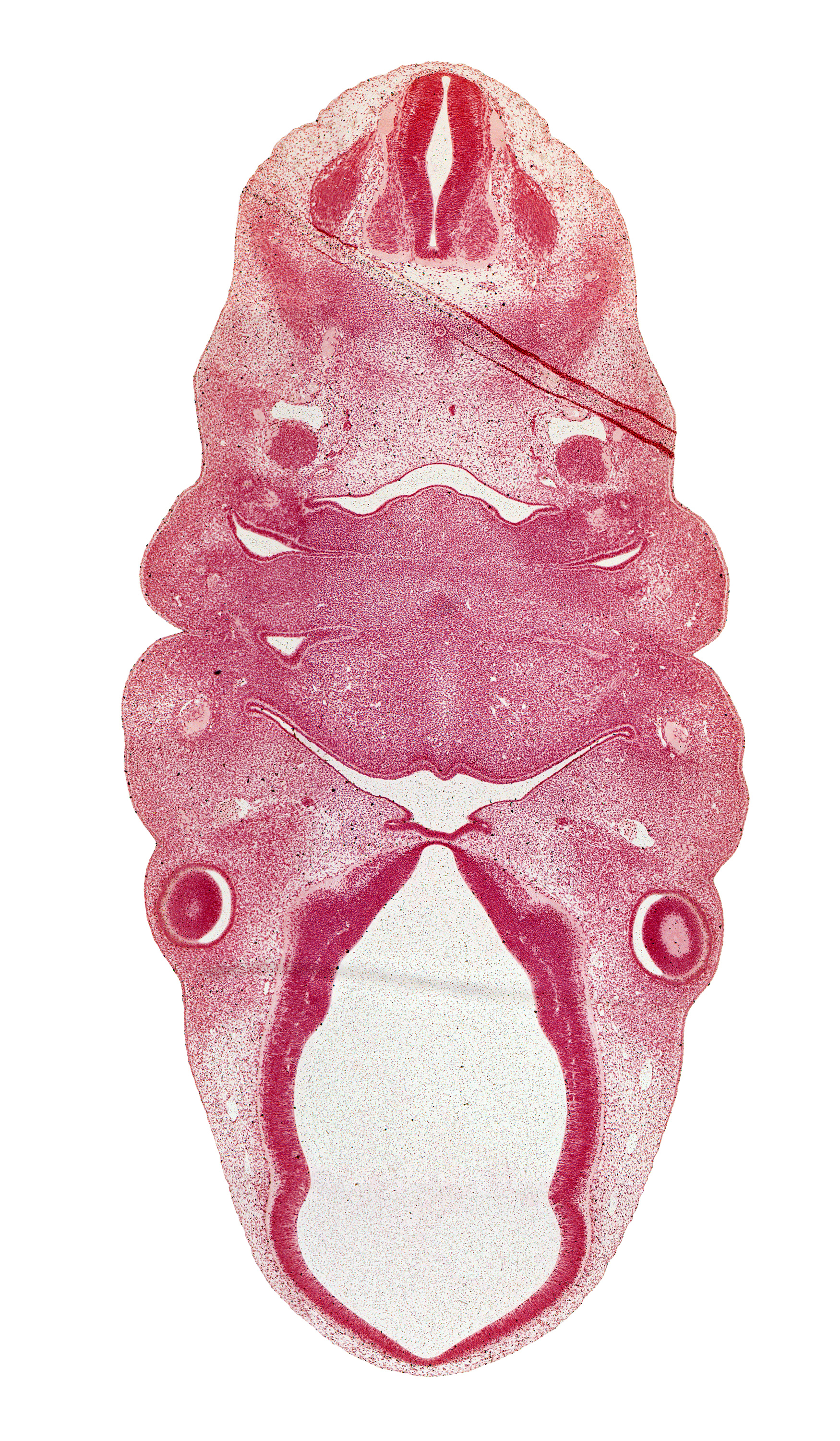 C-2 spinal ganglion, anterior dural venous plexus, dorsal primary ramus, dorsal root(s), epaxial part of myotome, extra-ocular premuscle mass, glossopharyngeal nerve (CN IX), internal carotid artery, lateral lingual swelling of tongue, marginal ridge, maxillary vein, optic stalk (CN II), oronasal cavity, pharynx, precardinal vein, primordial meninx, resorbing thyroglossal duct, spinal accessory nerve (CN XI), sternocleidomastoid / trapezius premuscle mass, terminal branches of facial nerve (CN VII), third ventricle, tuberculum impar
