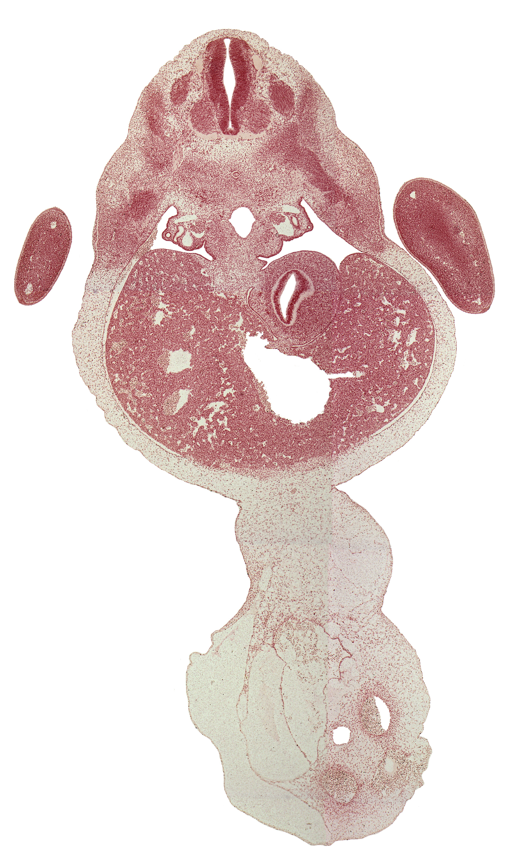 T-1 spinal ganglion, T-2 spinal nerve, afferent hepatic vein, aorta, ductus venosus, hepatic prominence, left lobe of liver, mesenchymal condensation around hindgut, mesonephric tubule(s), presumptive suprarenal gland cortex, right lobe of liver, stomach endoderm, suprarenal gland medulla, umbilical cord