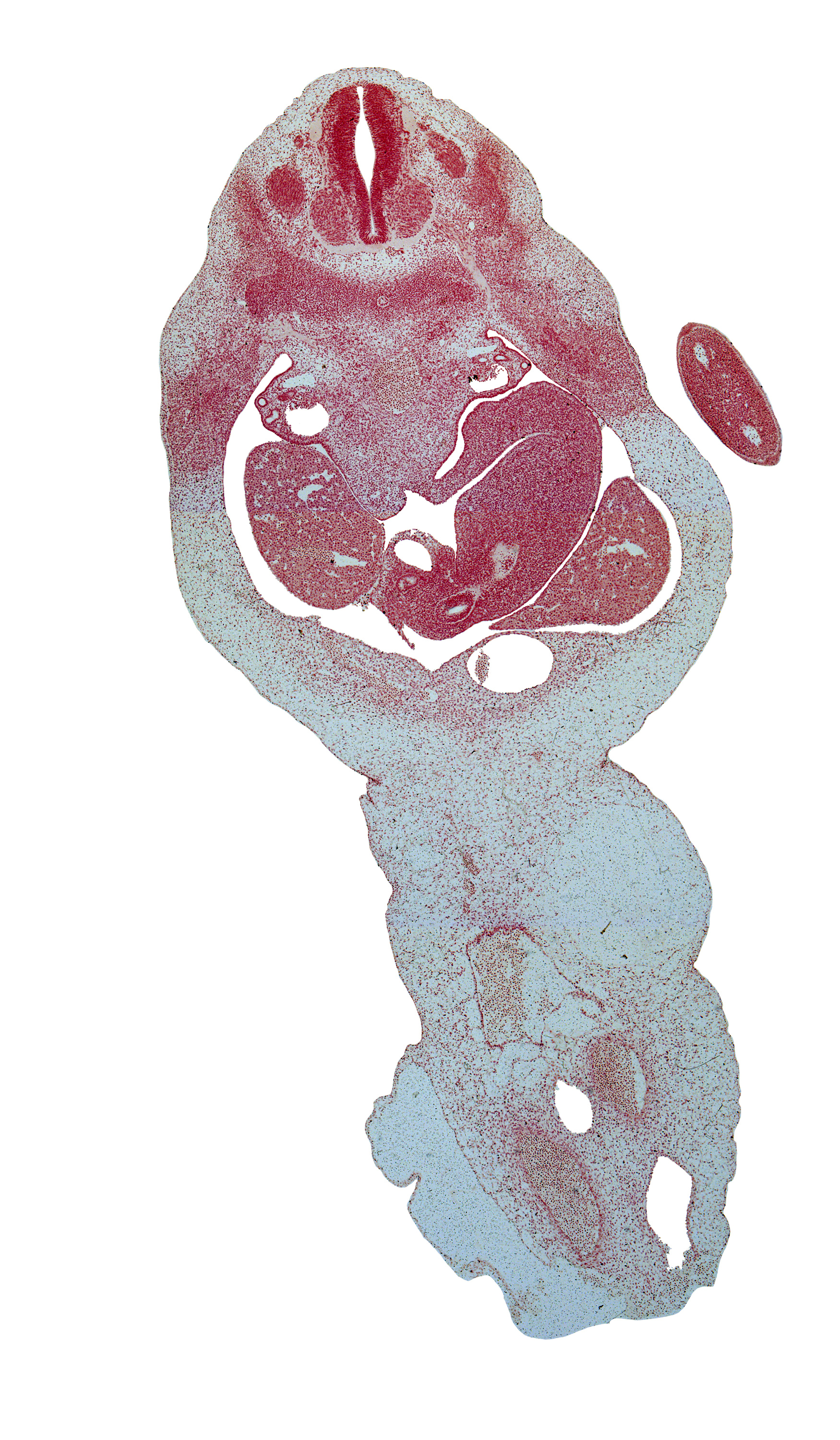 T-2 spinal ganglion, T-3 intercostal nerve, T-3 spinal nerve, dorsal mesogastrium, duodenum, epaxial part of myotome, epiploic foramen, hand plate, left lobe of liver, lesser sac (omental bursa), marginal vein, neural arch, right lobe of liver, spleen, umbilical cord, umbilical vein