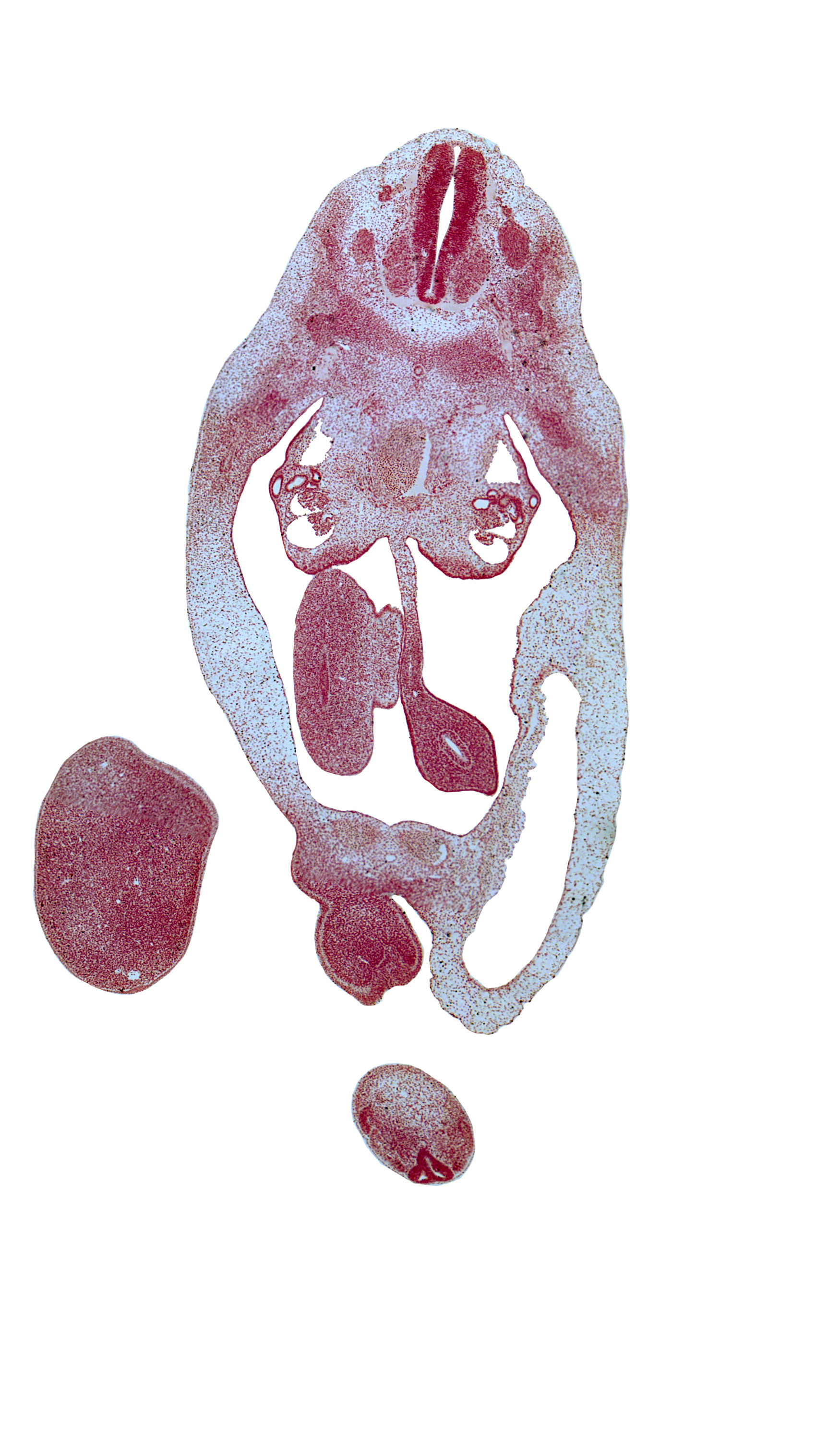 T-6 spinal ganglion, T-7 spinal nerve, allantois, blastema of rib 8, caudal eminence, cecum of midgut, dense caudal part of sclerotome, gonadal ridge, labioscrotal swelling, left umbilical artery, leg, mesentery of midgut, mesoderm, neural arch, notochord, primordial urethral fold, right umbilical artery, superior mesenteric artery, sympathetic trunk, urethral groove