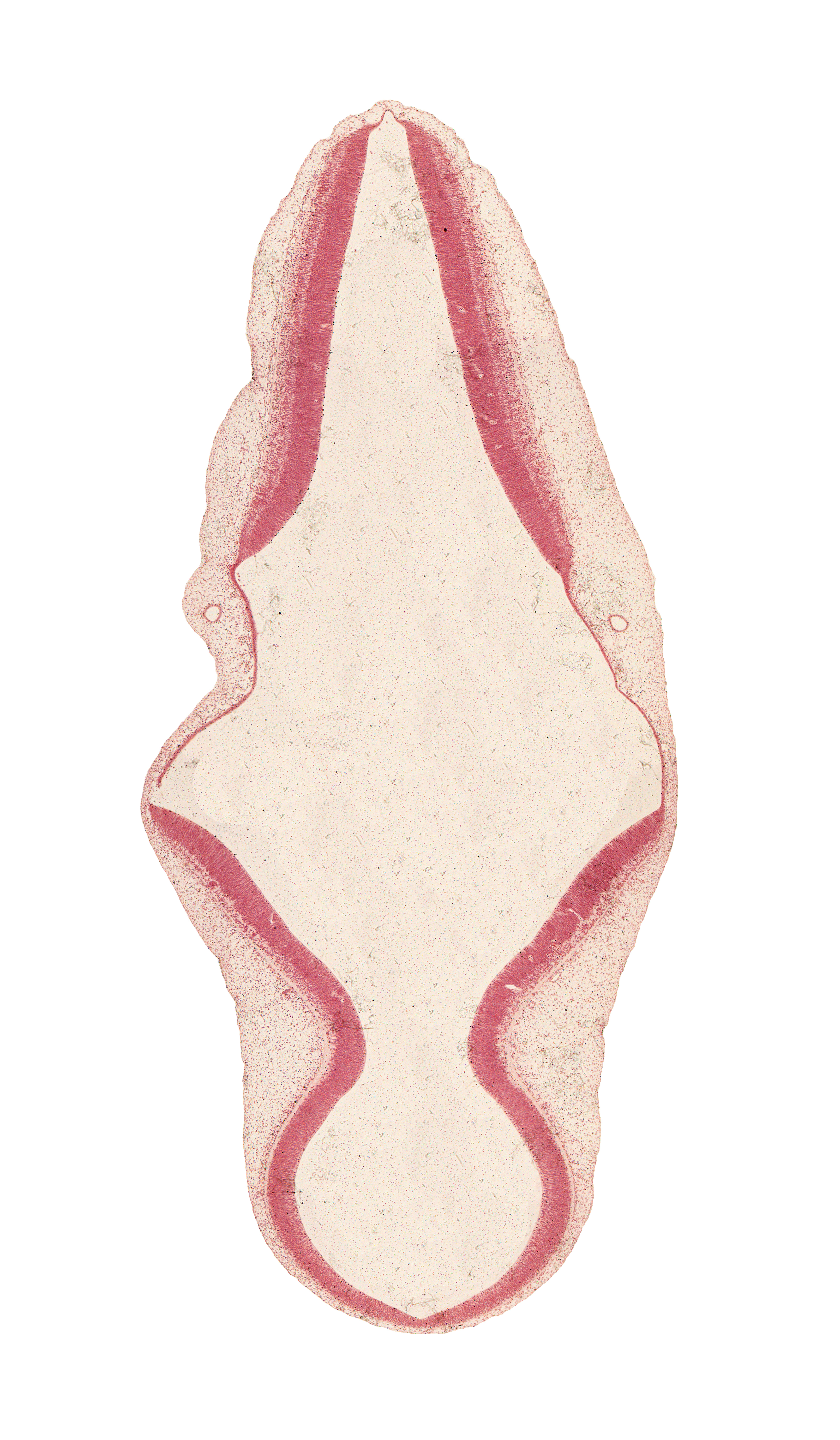 artifact separation(s), endolymphatic duct, intermediate zone, mesencephalon, mesencoel (cerebral aqueduct), primordial meninx, rhombencoel (fourth ventricle), roof plate of myelencephalon, roof plate of rhombencephalon, surface ectoderm, tectum, tegmentum, trochlear nerve (CN IV), ventricular zone