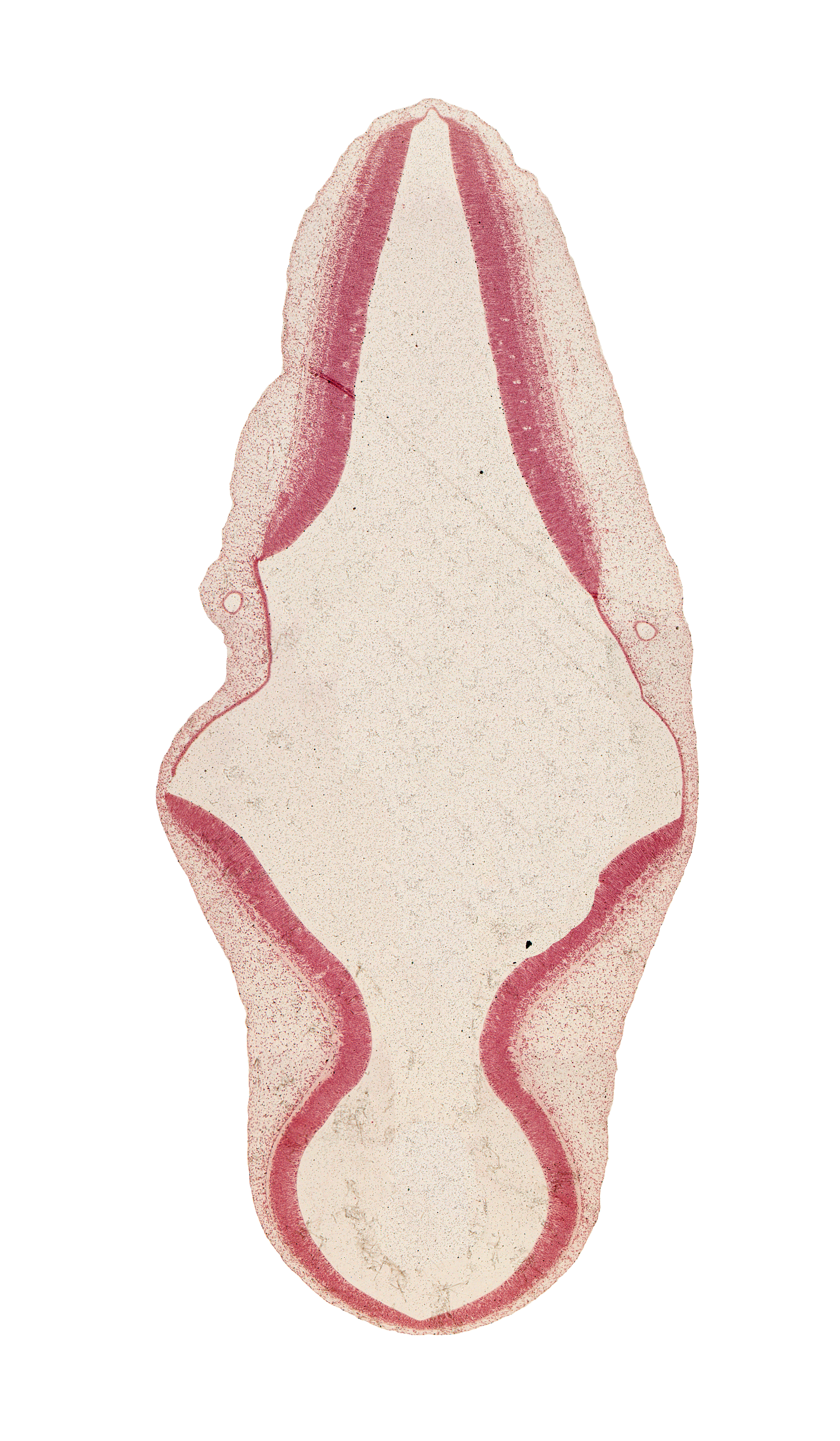 alar plate(s), artifact separation(s), basal plate, endolymphatic duct, head mesenchyme, intermediate zone, marginal zone, mesencephalon (M2), myelencephalon, roof plate, roof plate of rhombencephalon, sulcus limitans, tectum, tegmentum, ventricular zone