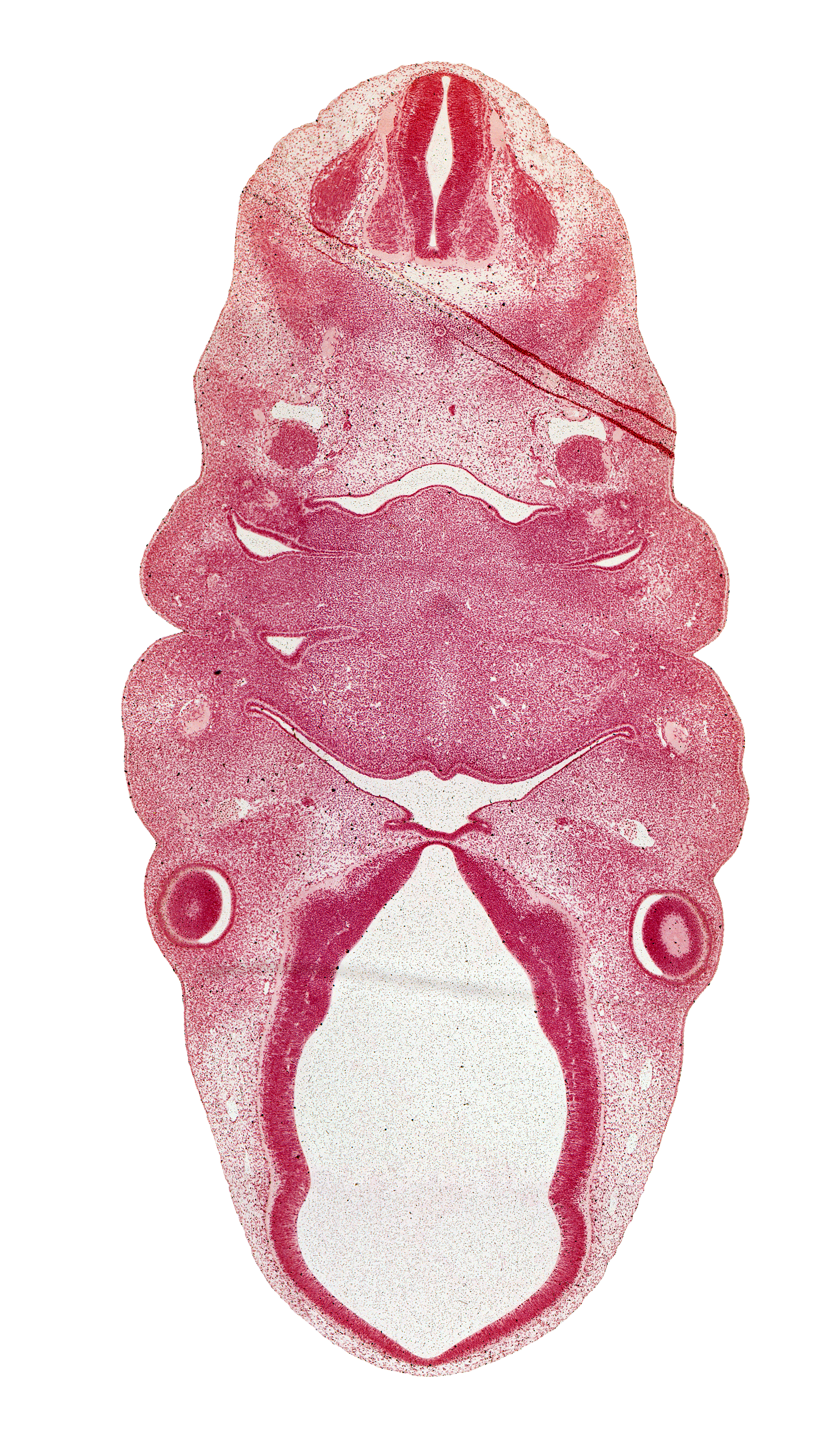 C-2 spinal ganglion, anterior dural venous plexus, dorsal primary ramus, dorsal root(s), epaxial part of myotome, extra-ocular premuscle mass, glossopharyngeal nerve (CN IX), internal carotid artery, lateral lingual swelling of tongue, marginal ridge, maxillary vein, optic stalk (CN II), oronasal cavity, pharynx, precardinal vein, primordial meninx, resorbing thyroglossal duct, spinal accessory nerve (CN XI), sternocleidomastoid / trapezius premuscle mass, terminal branches of facial nerve (CN VII), third ventricle, tuberculum impar